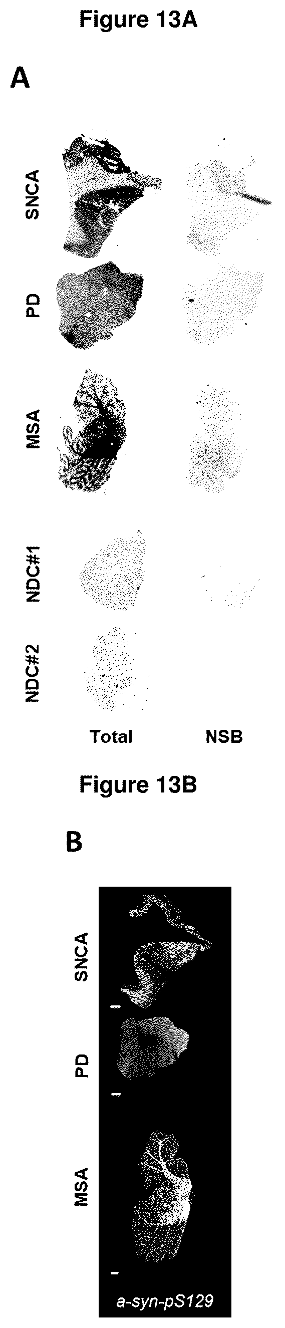 Patent US12552800 Figure 13 – Compounds for diagnosis