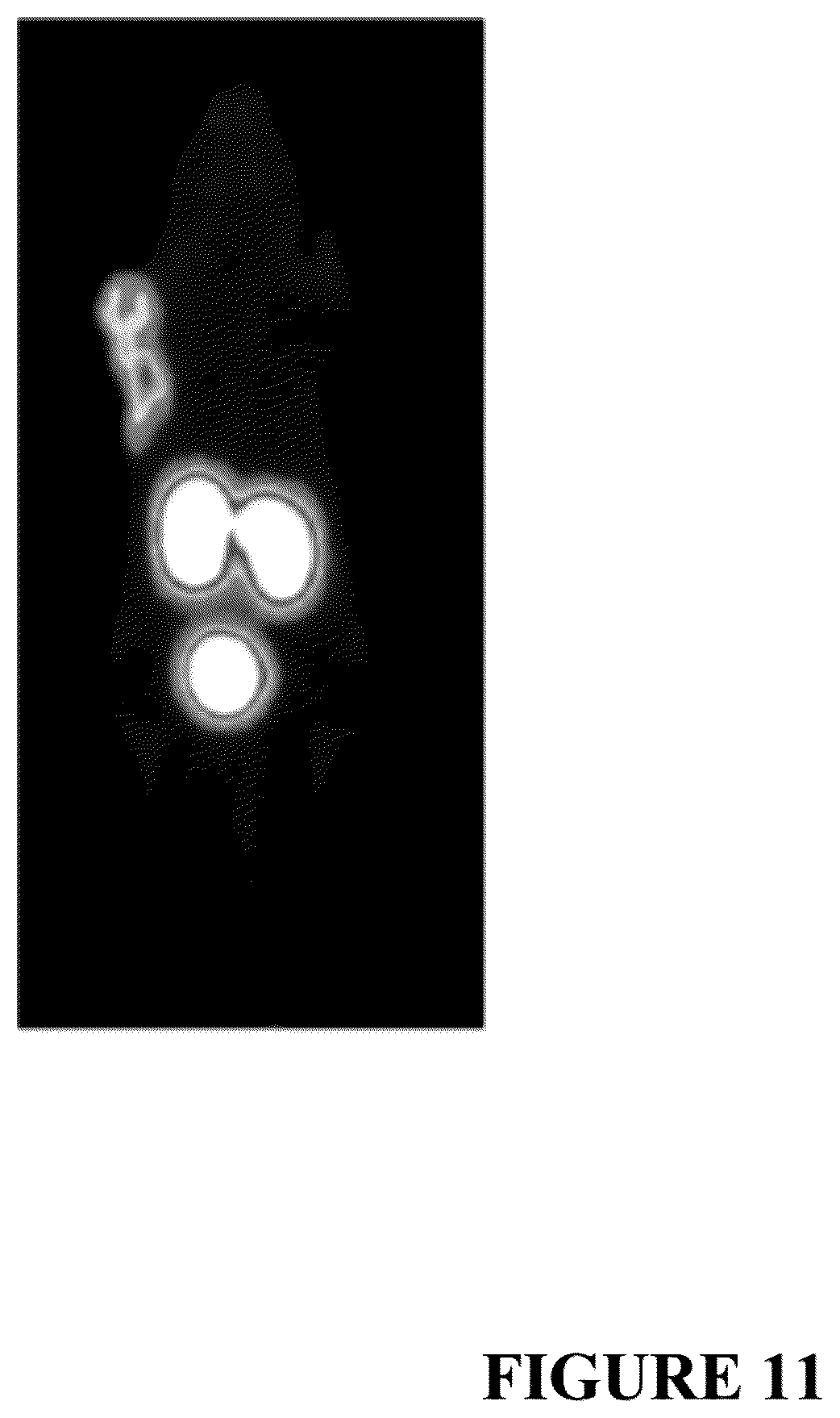 Patent US12552837 Figure 11 – Bicyclic peptide ligands with detectable moieties and uses thereof