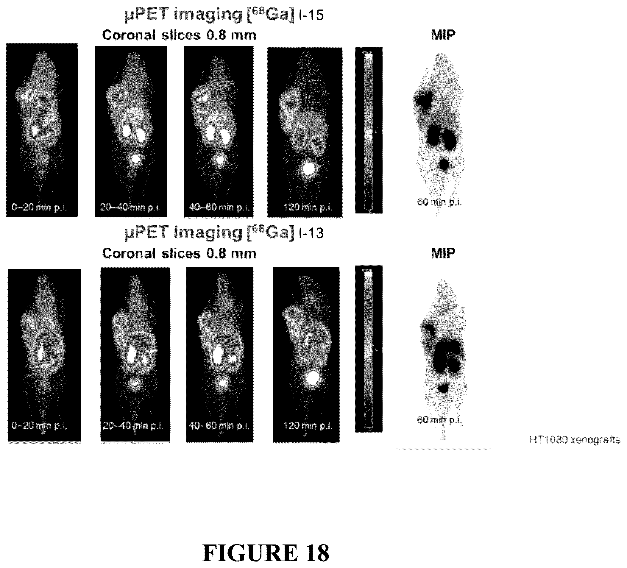 Patent US12552837 Figure 18 – Bicyclic peptide ligands with detectable moieties and uses thereof