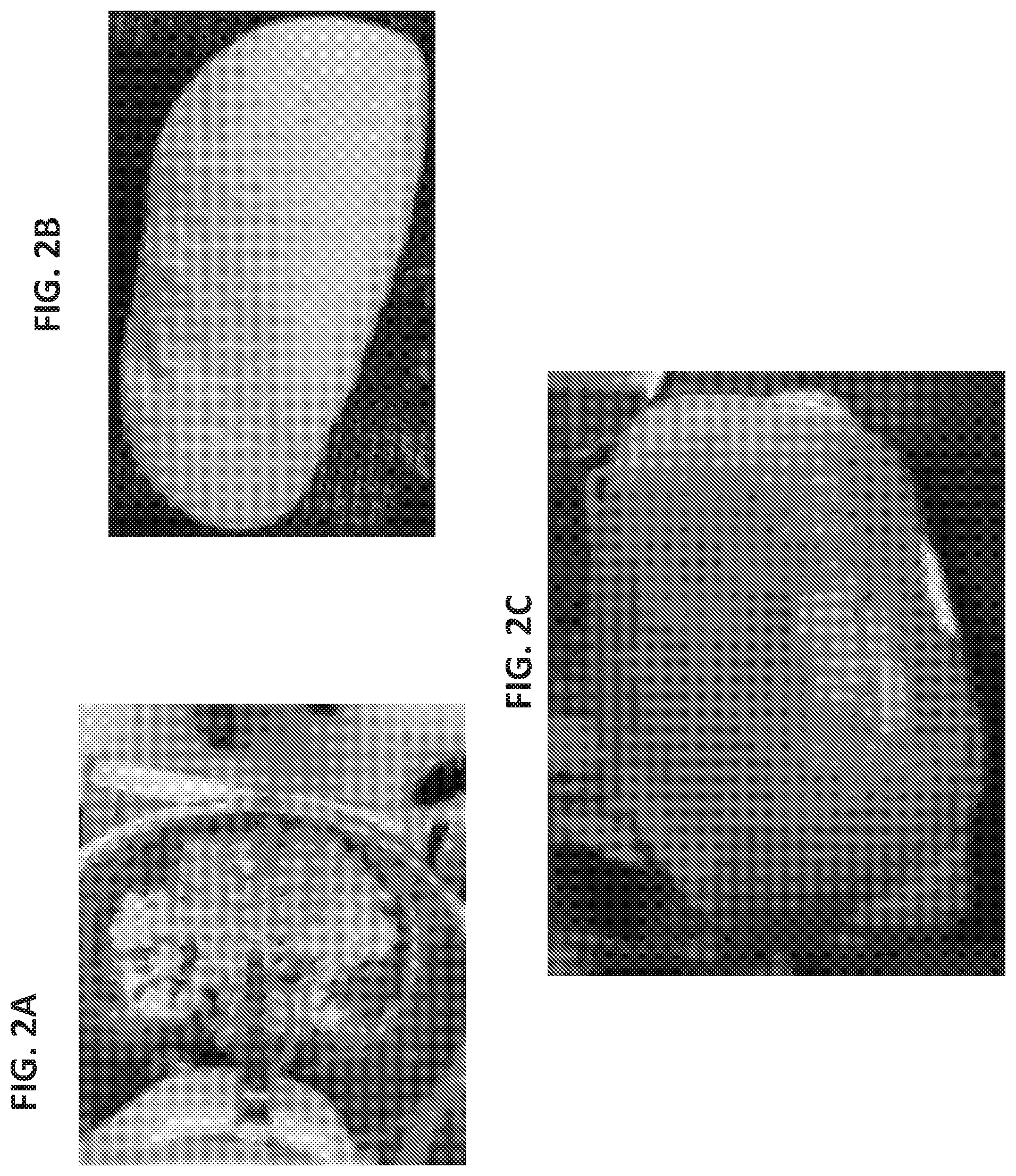 Patent US12552844 Figure 2 – De-epitoped alpha gliadin and use of same for the management of celiac disease and gluten sensitivity