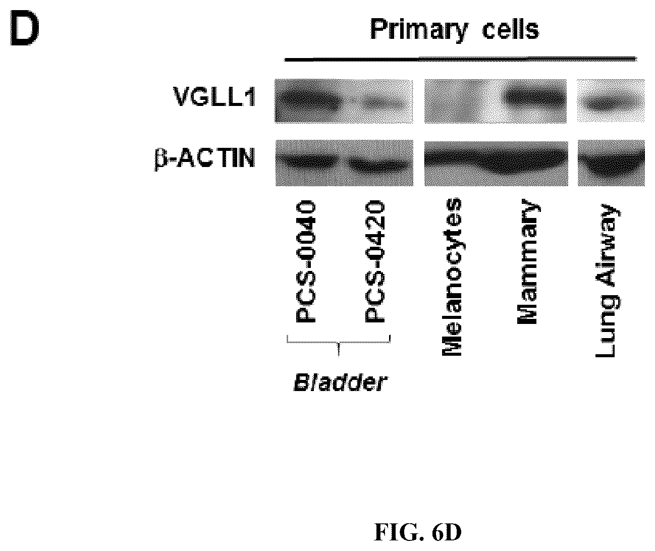 Patent US12552851 Figure 17 – T cell receptors with VGLL1 specificity and uses thereof