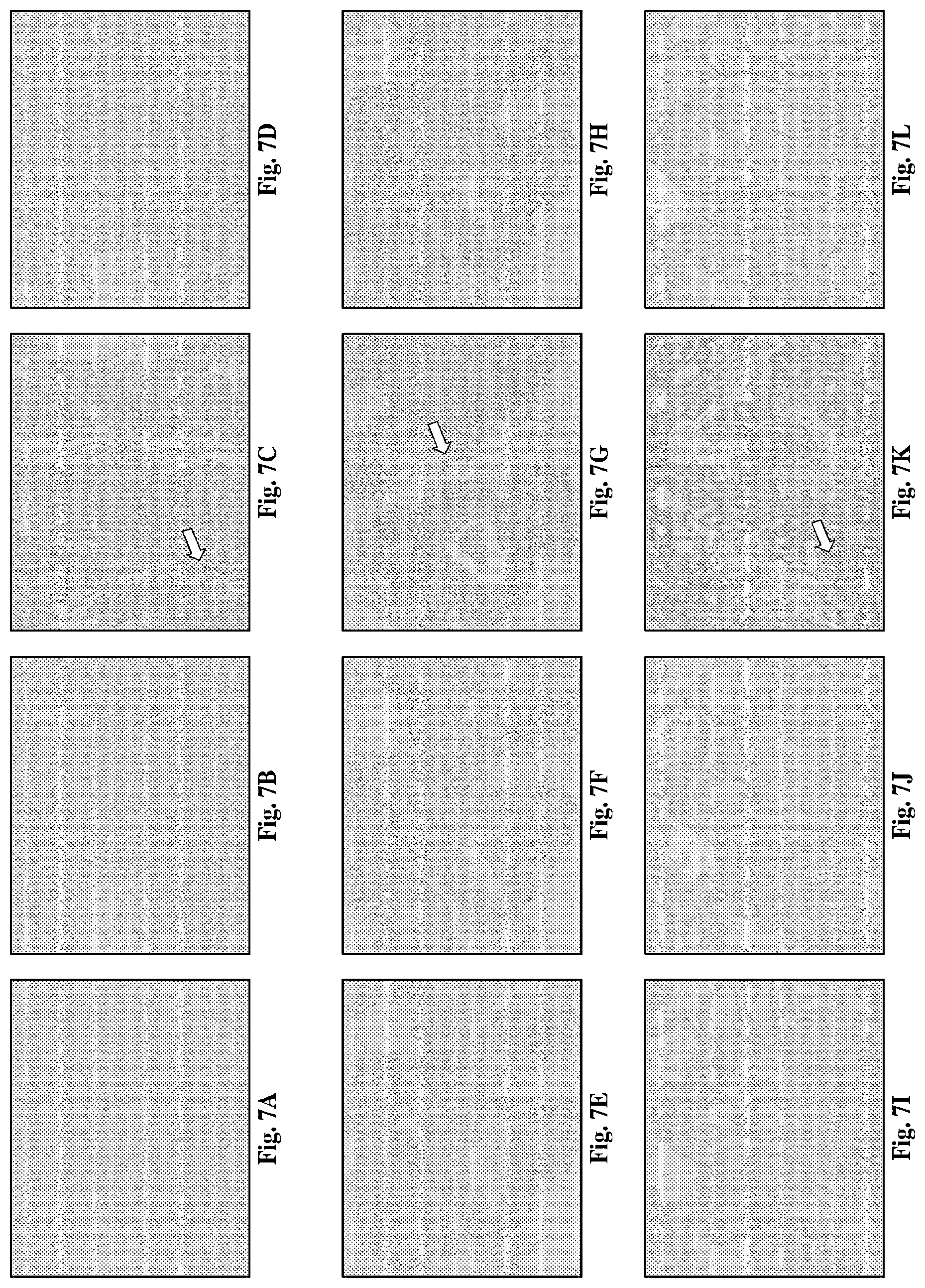 Patent US12552868 Figure 15 – Antibodies that bind to AXL proteins