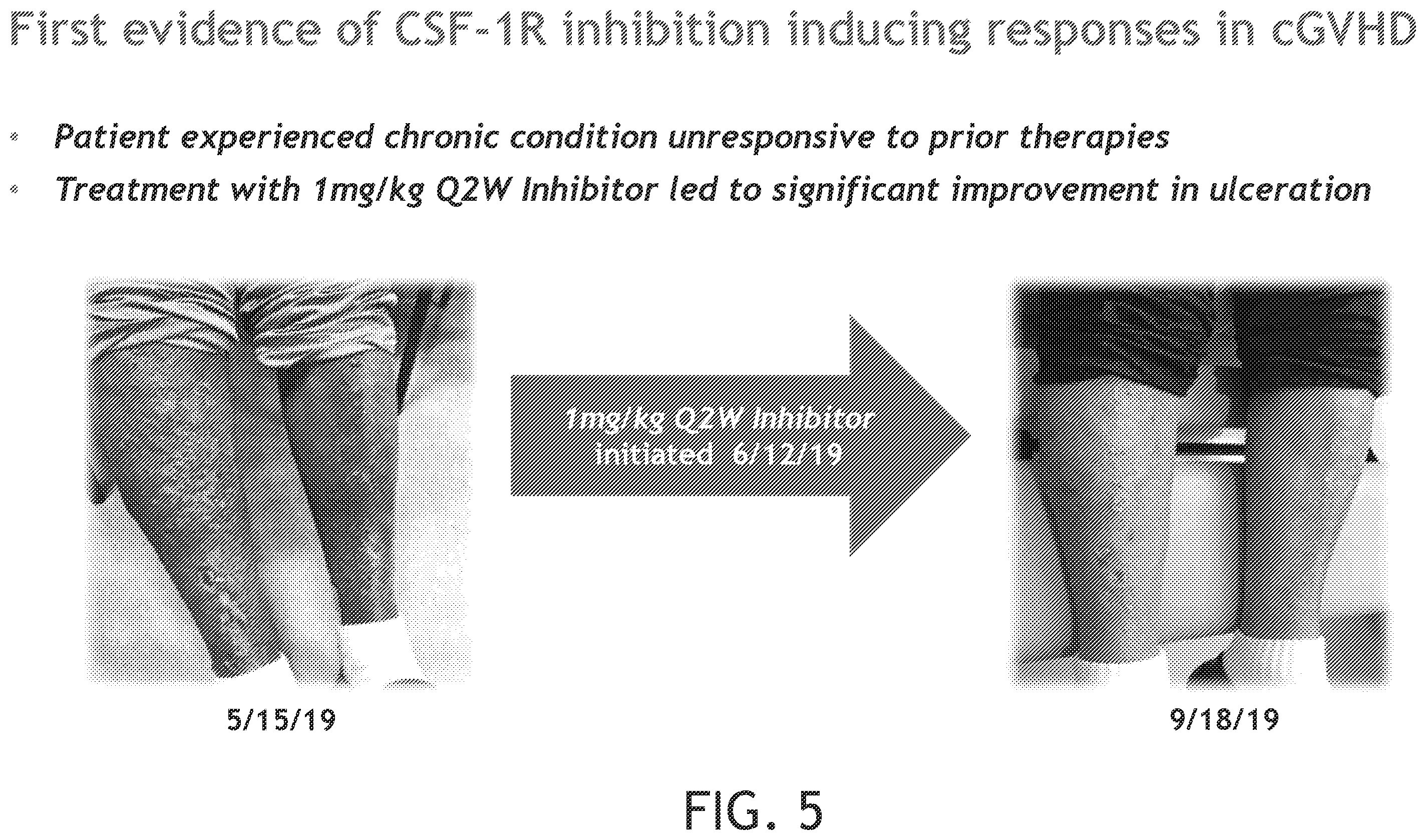 Patent US12552869 Figure 5 – CSF-1R antibodies for the treatment of chronic graft versus host disease