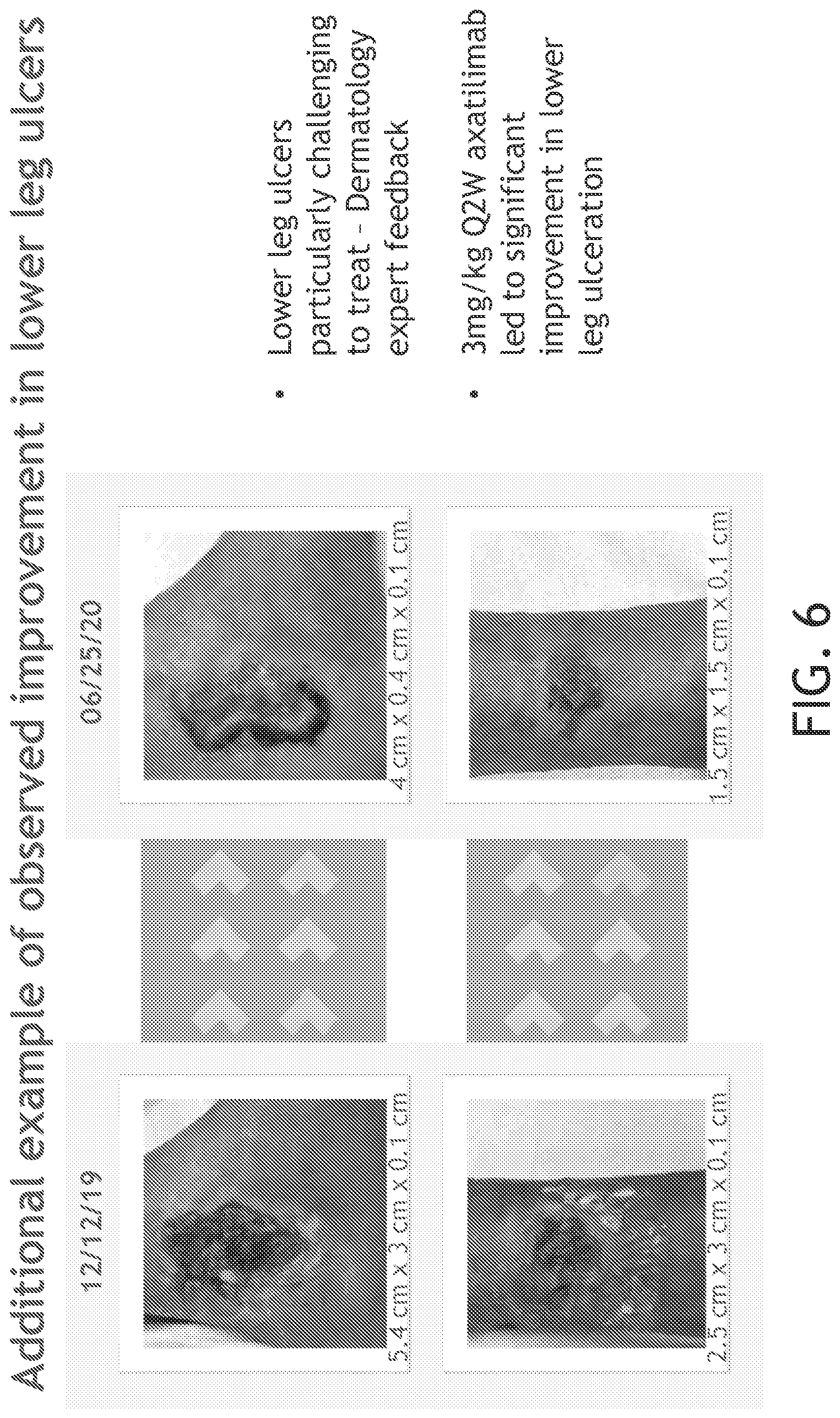 Patent US12552869 Figure 6 – CSF-1R antibodies for the treatment of chronic graft versus host disease