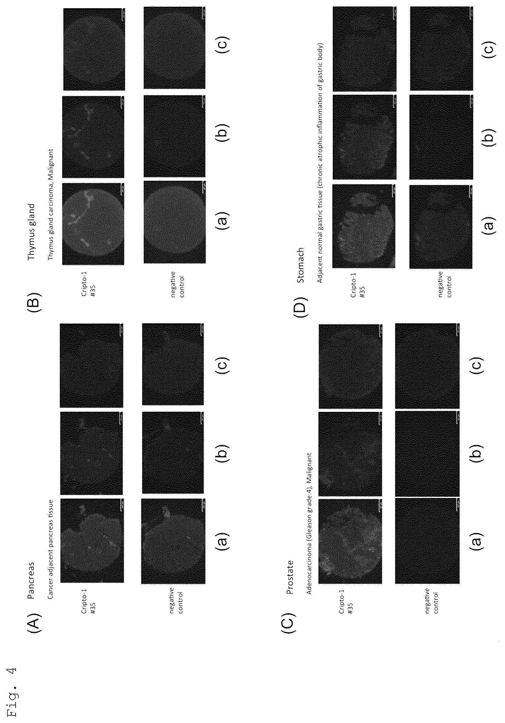 Patent US12552875 Figure 4 – Anti-human Cripto-1 antibody