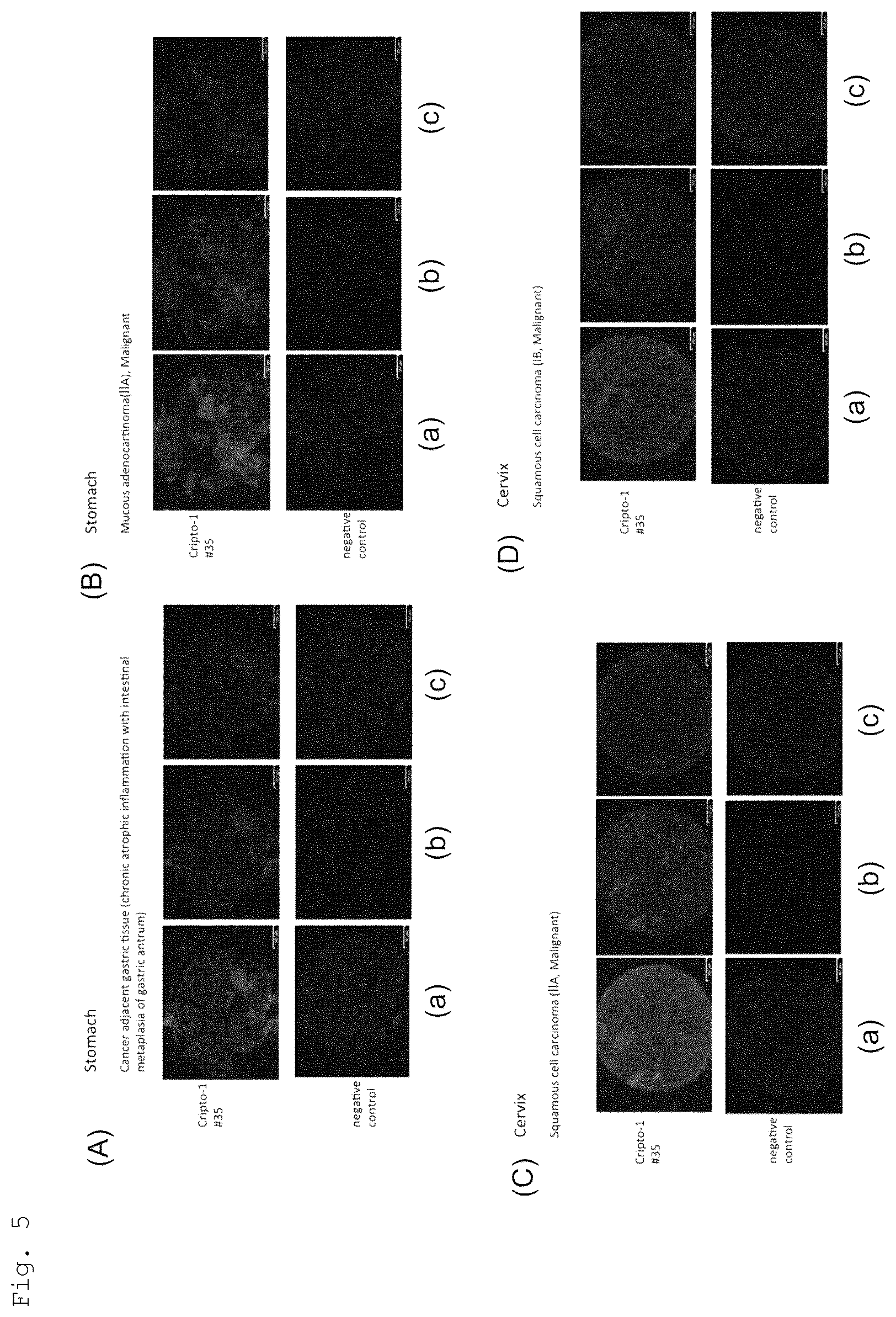 Patent US12552875 Figure 5 – Anti-human Cripto-1 antibody