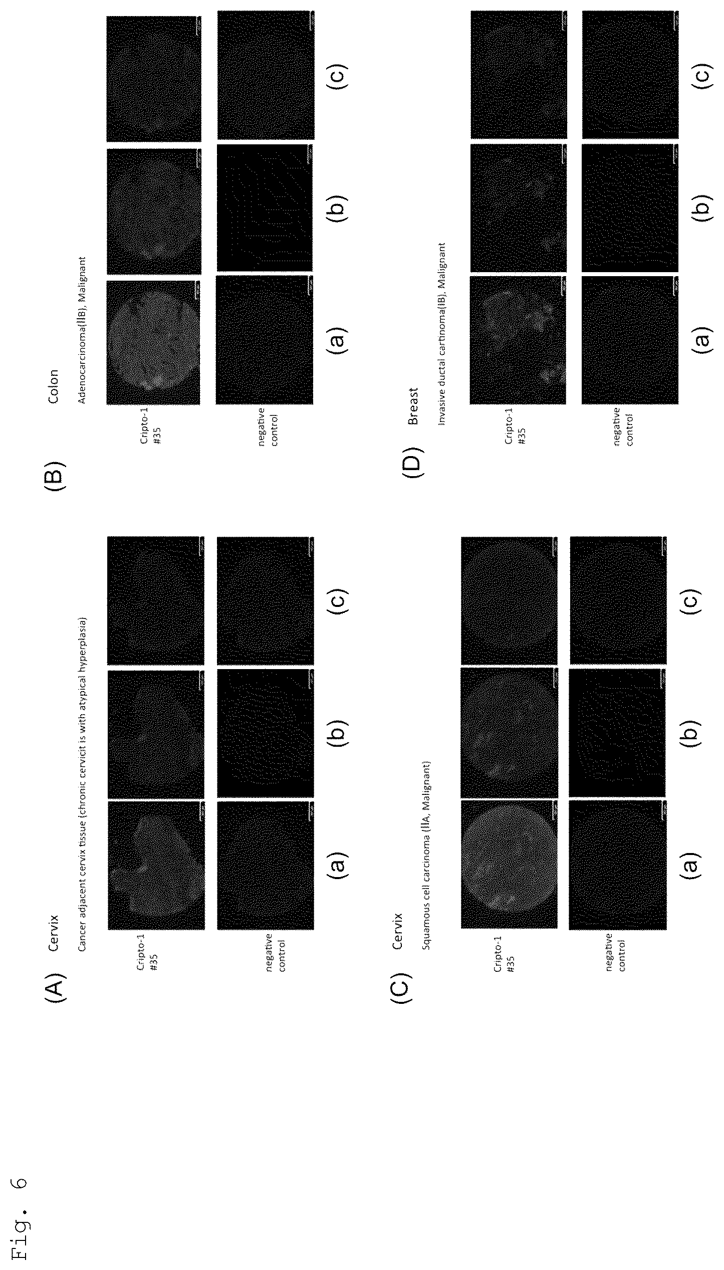Patent US12552875 Figure 6 – Anti-human Cripto-1 antibody
