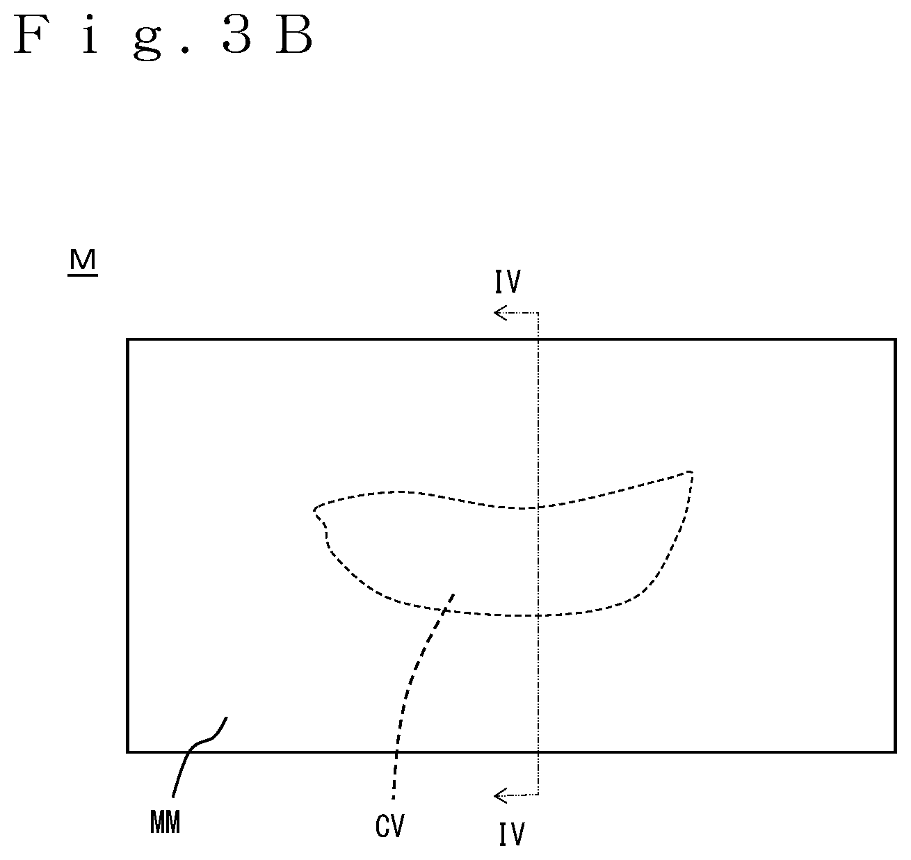 Patent US12552925 Figure 4 – Injection molded article and shoe