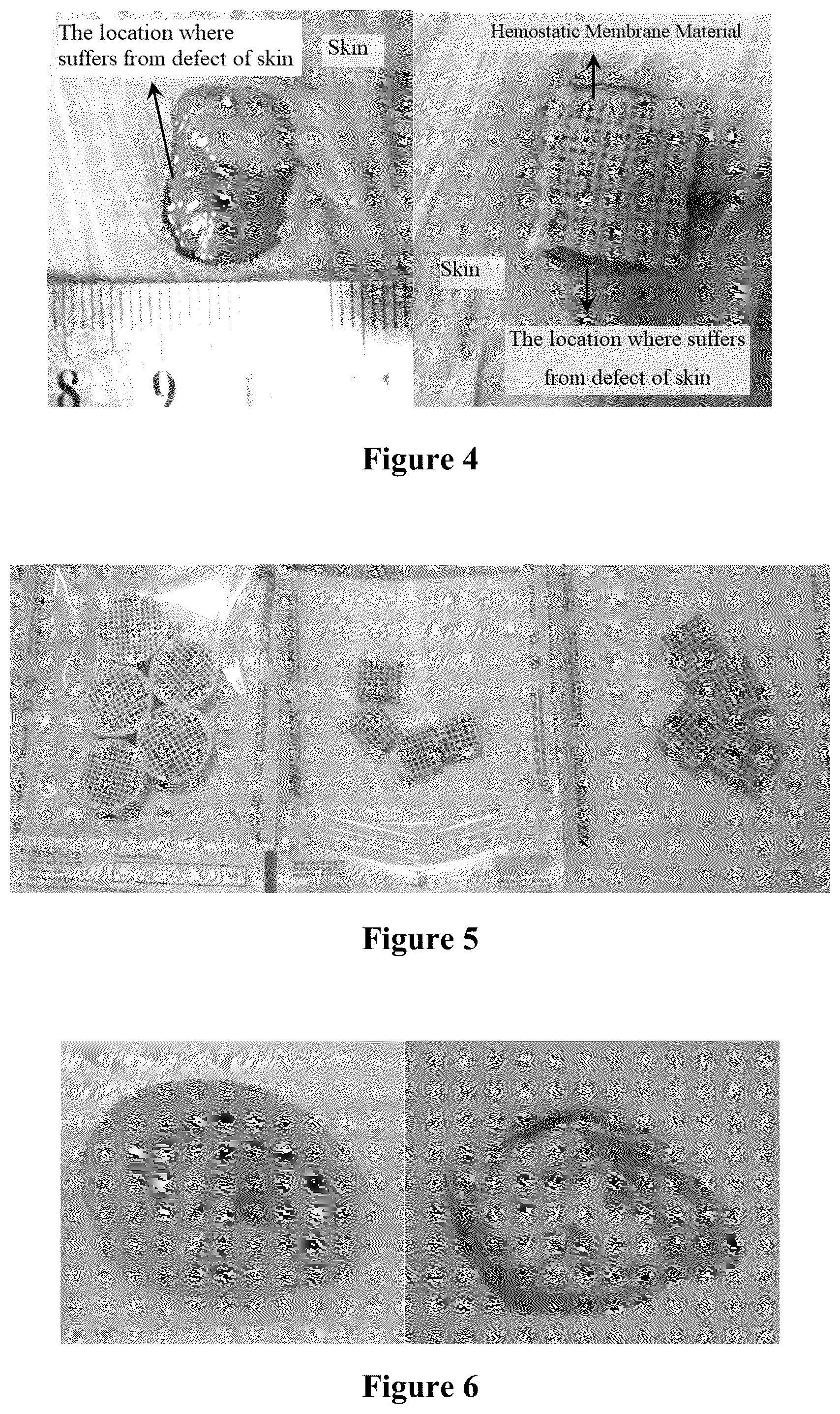 Patent US12552947 Figure 2 – Bioink for 3D printing, the preparation method and usage