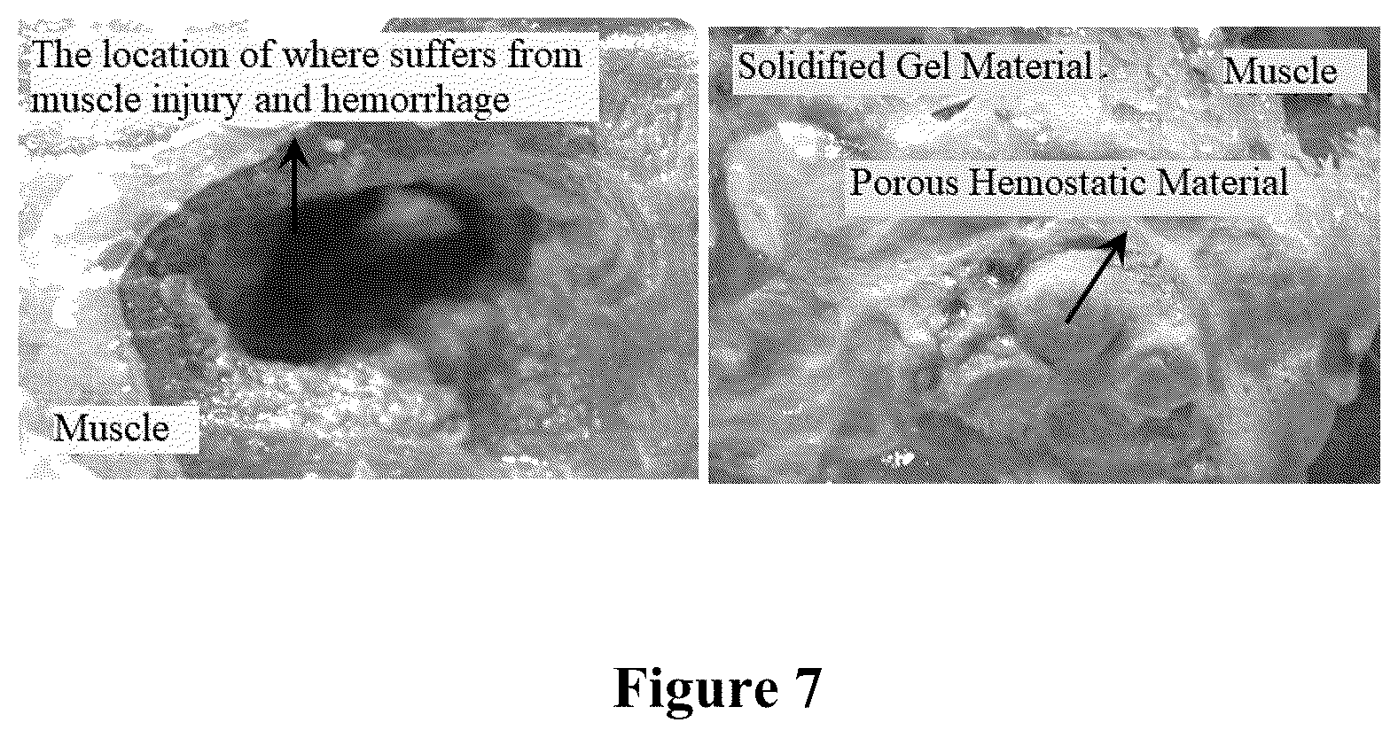 Patent US12552947 Figure 3 – Bioink for 3D printing, the preparation method and usage