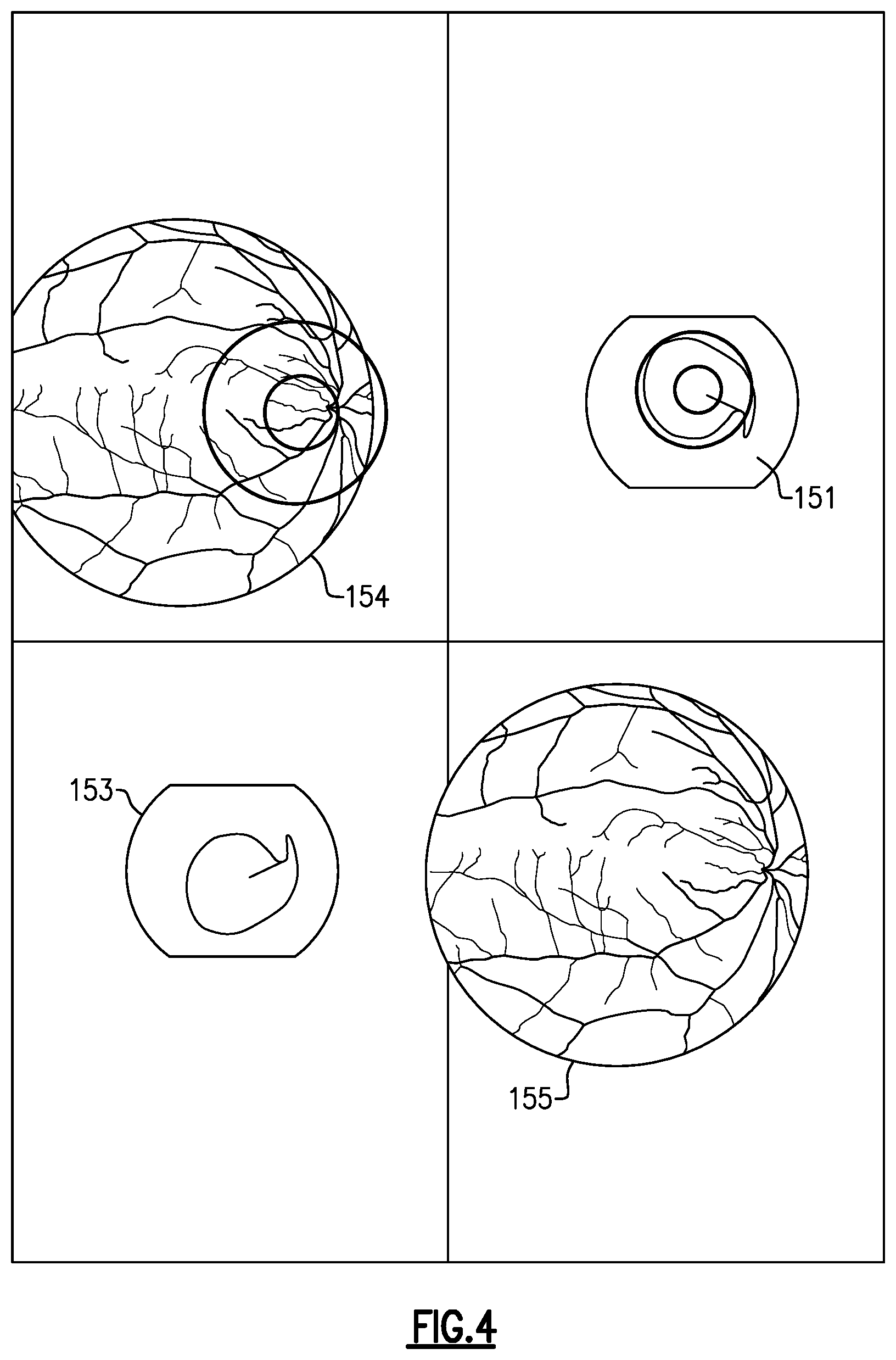 Patent US12562079 Figure 5 – Medical device packaging with integrated training or teaching simulator