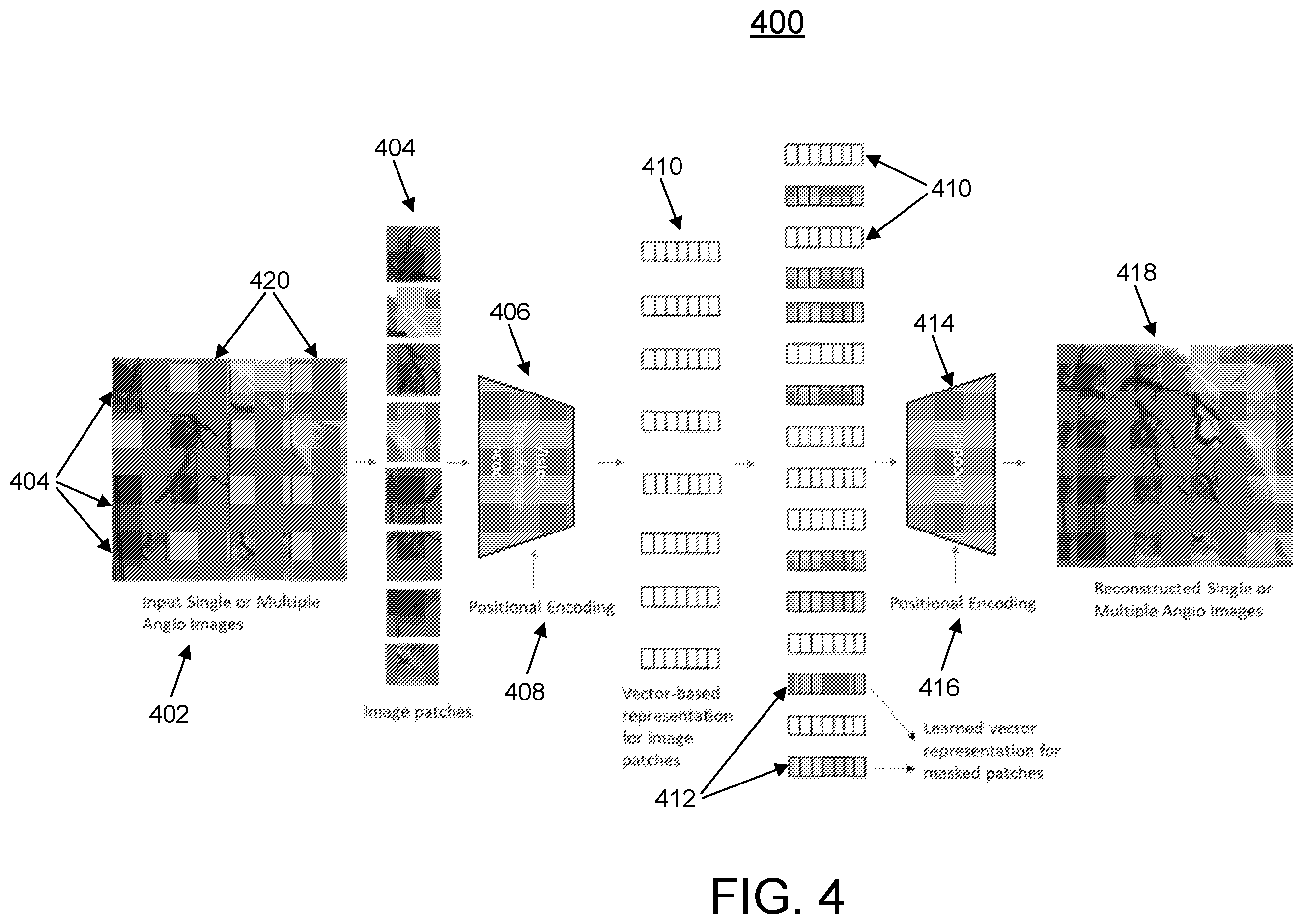 Patent US12562259 Figure 4 – AI-based analysis of coronary angiograms
