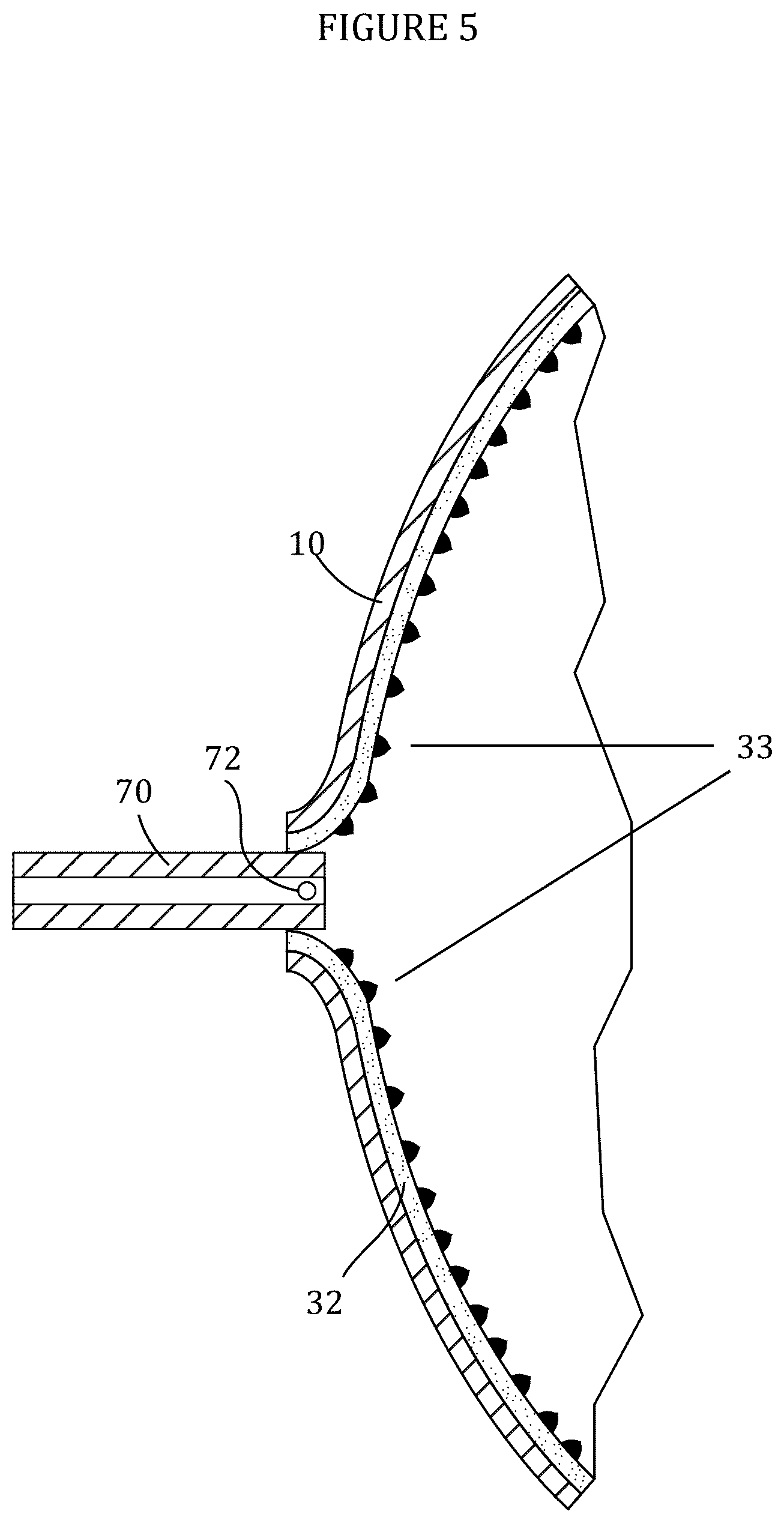 Patent US12562267 Figure 5 – Sound directing device for a mobile telecommunication device having microbial barrier properties