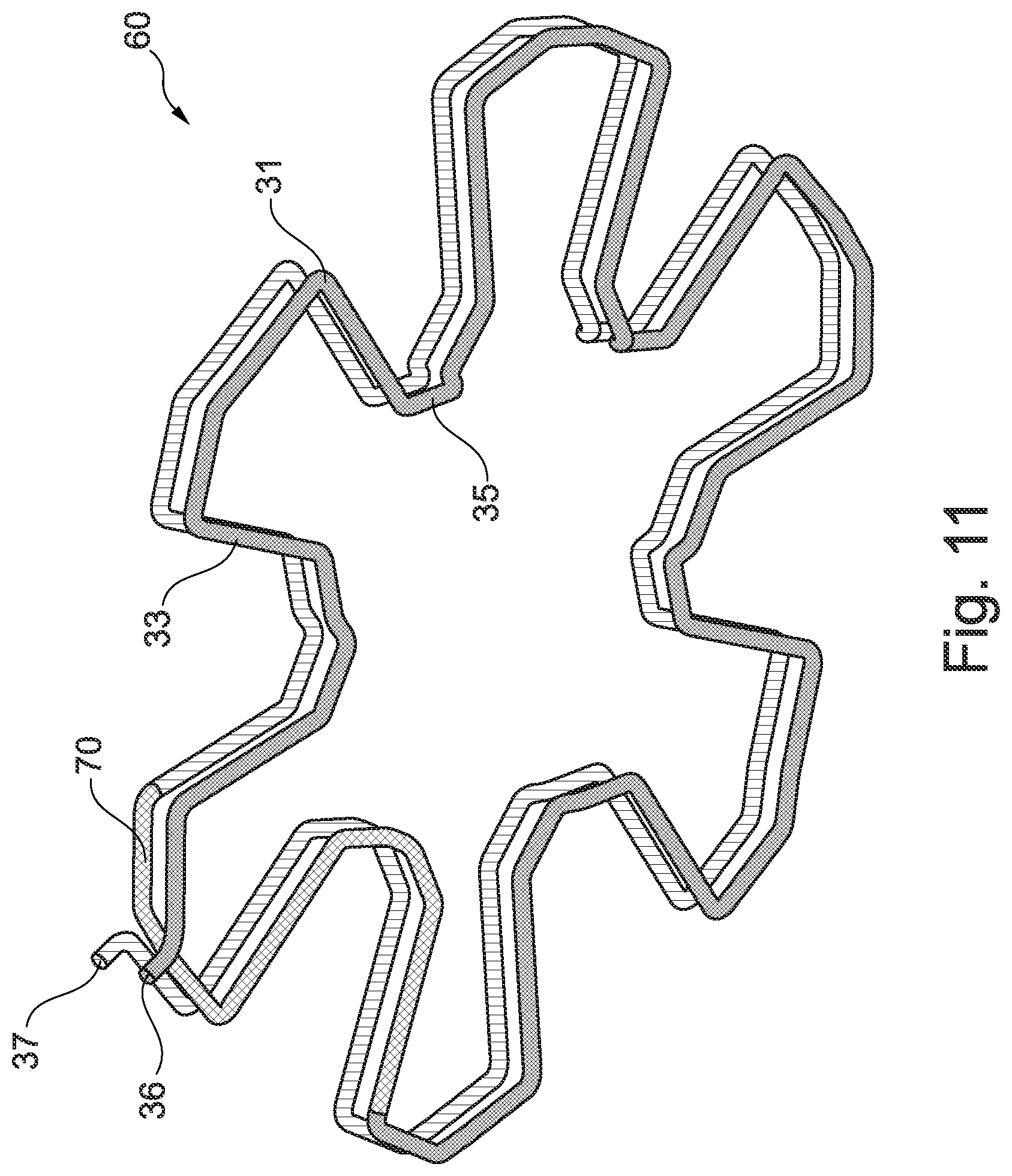 Patent US12562628 Figure 5 – Method for producing a winding for a stator in an electric rotating machine, stator, method for producing the stator and electric rotating machine