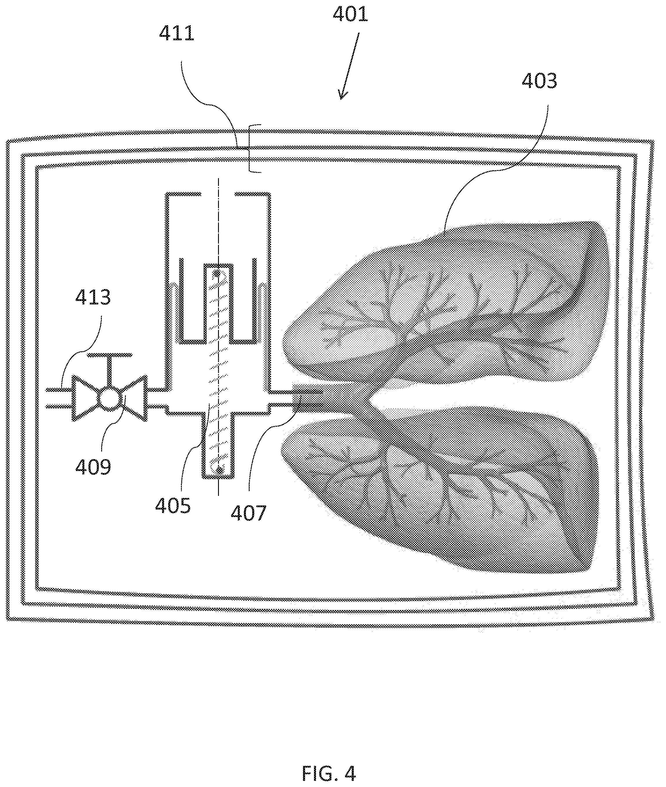 Patent US12564187 Figure 4 – Apparatus for tissue transport and preservation