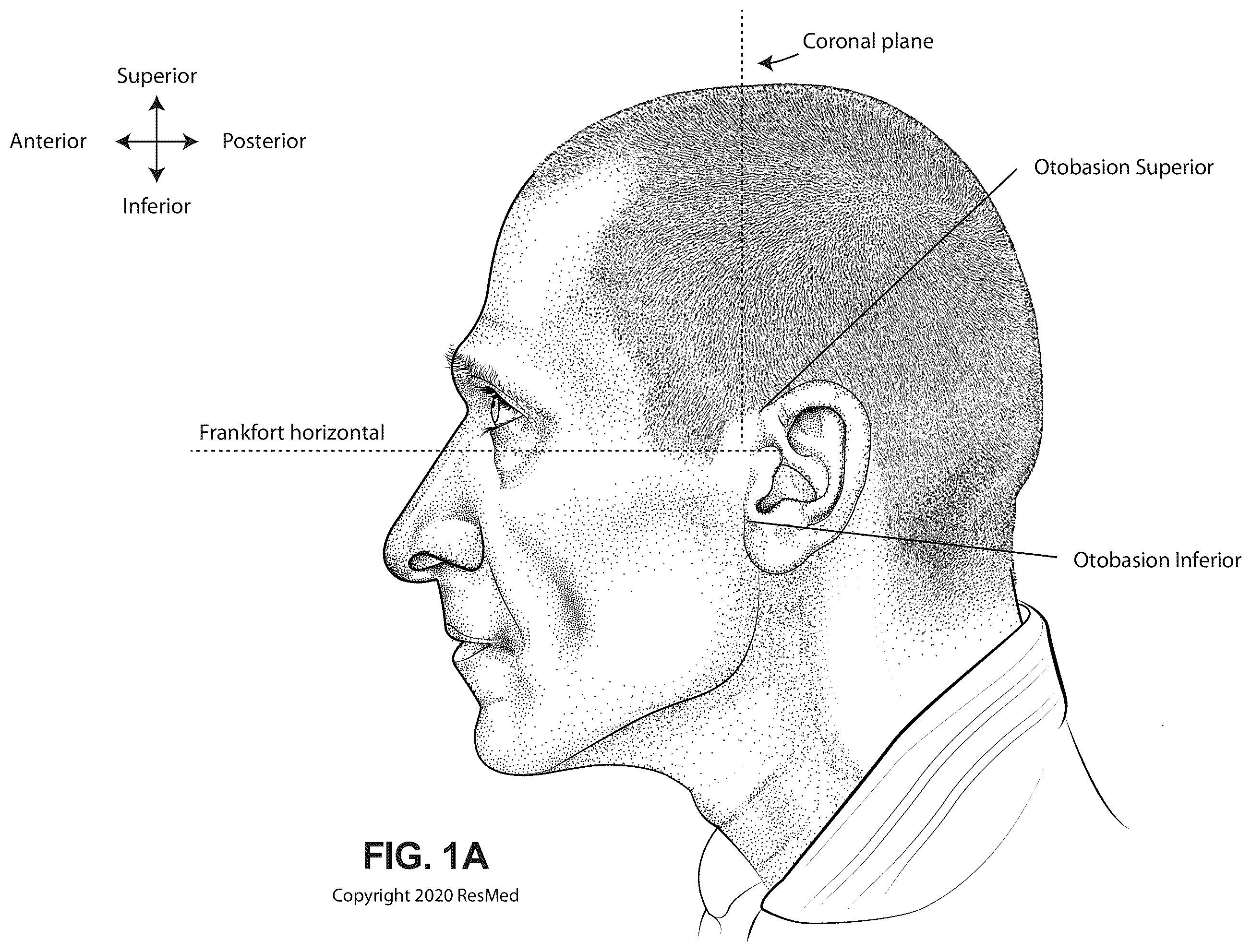 Patent US12564236 Figure 1 – Positioning and stabilising structure and system incorporating same