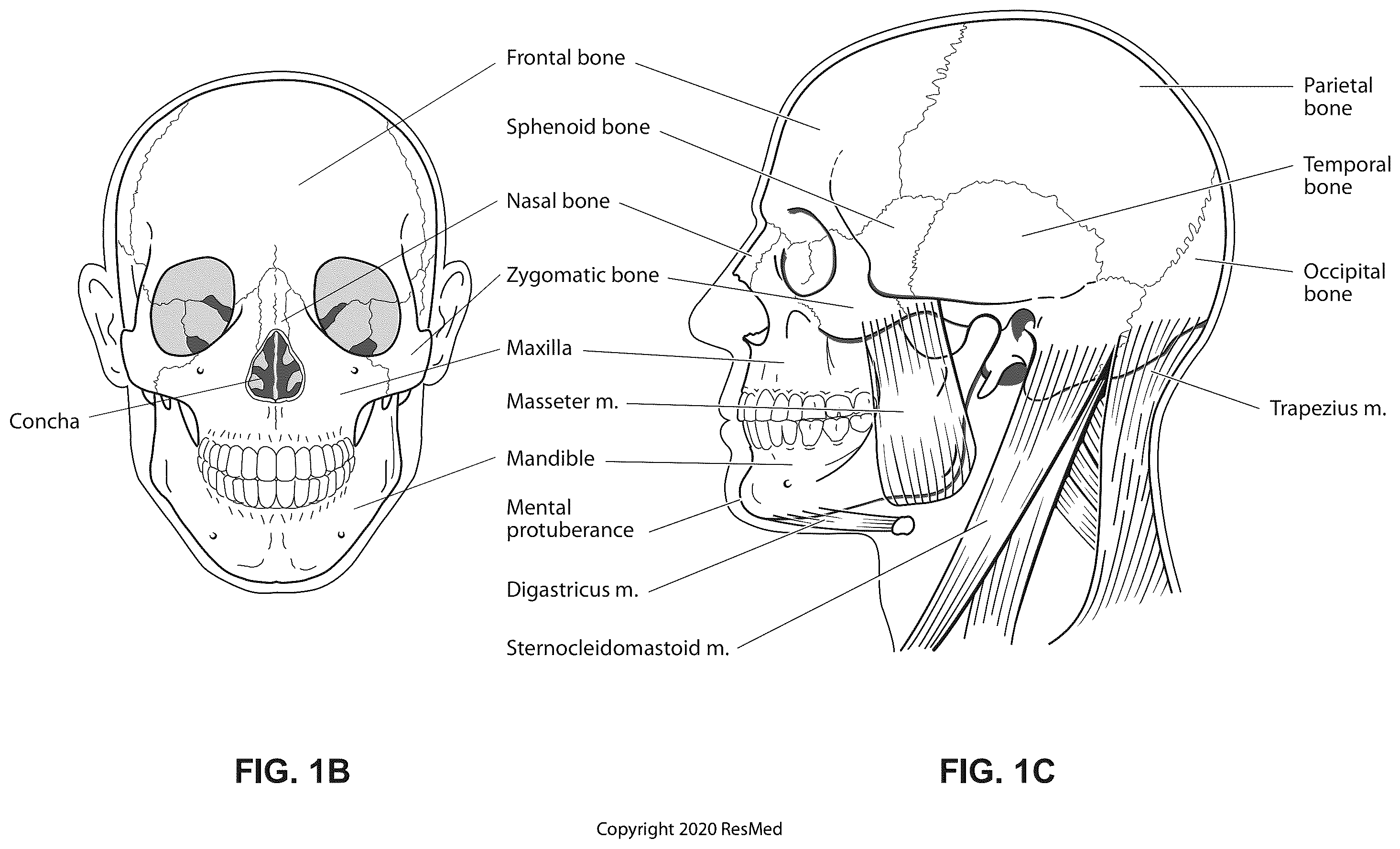 Patent US12564236 Figure 2 – Positioning and stabilising structure and system incorporating same