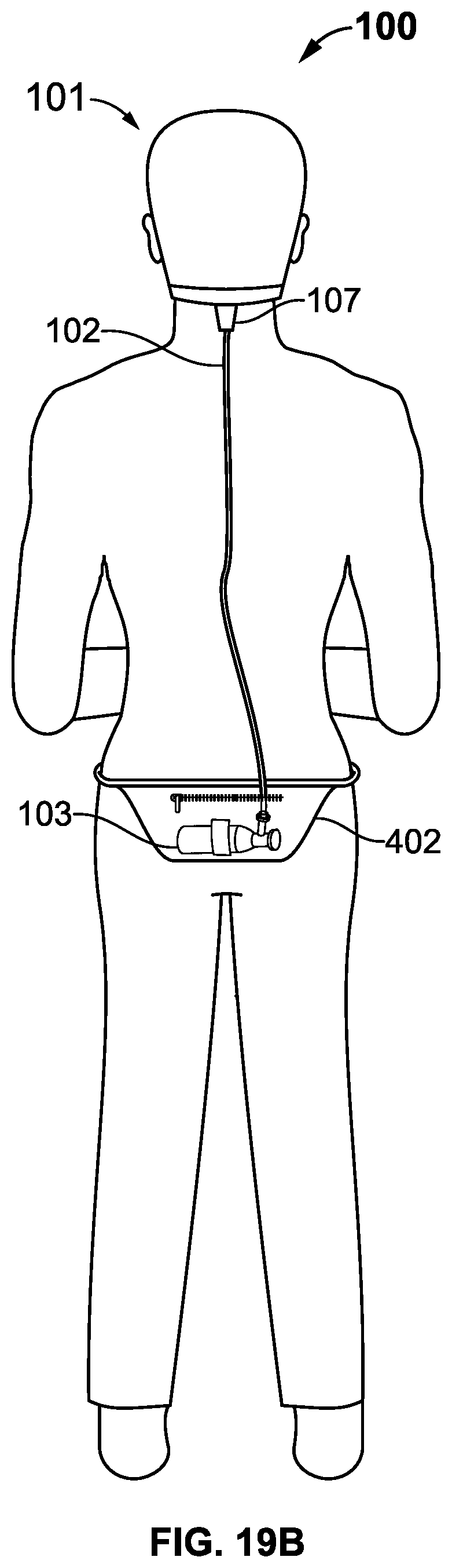 Patent US12564254 Figure 16 – Apparatus for hair cooling and dehumidification
