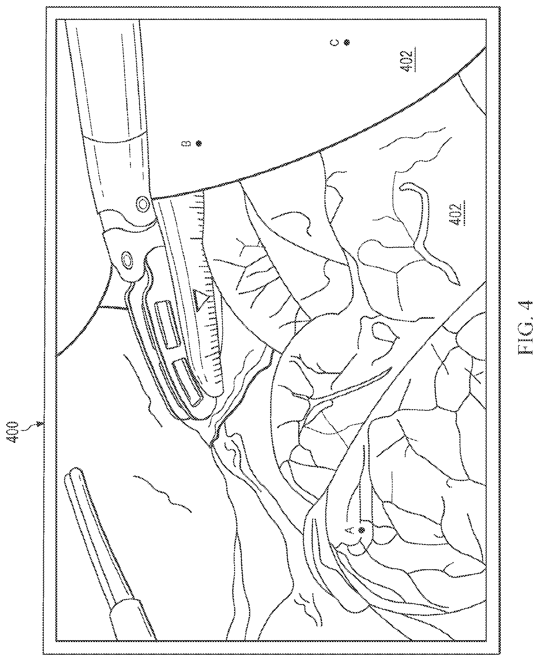 Patent US12564306 Figure 5 – Systems and methods for depth-based measurement in a three-dimensional view