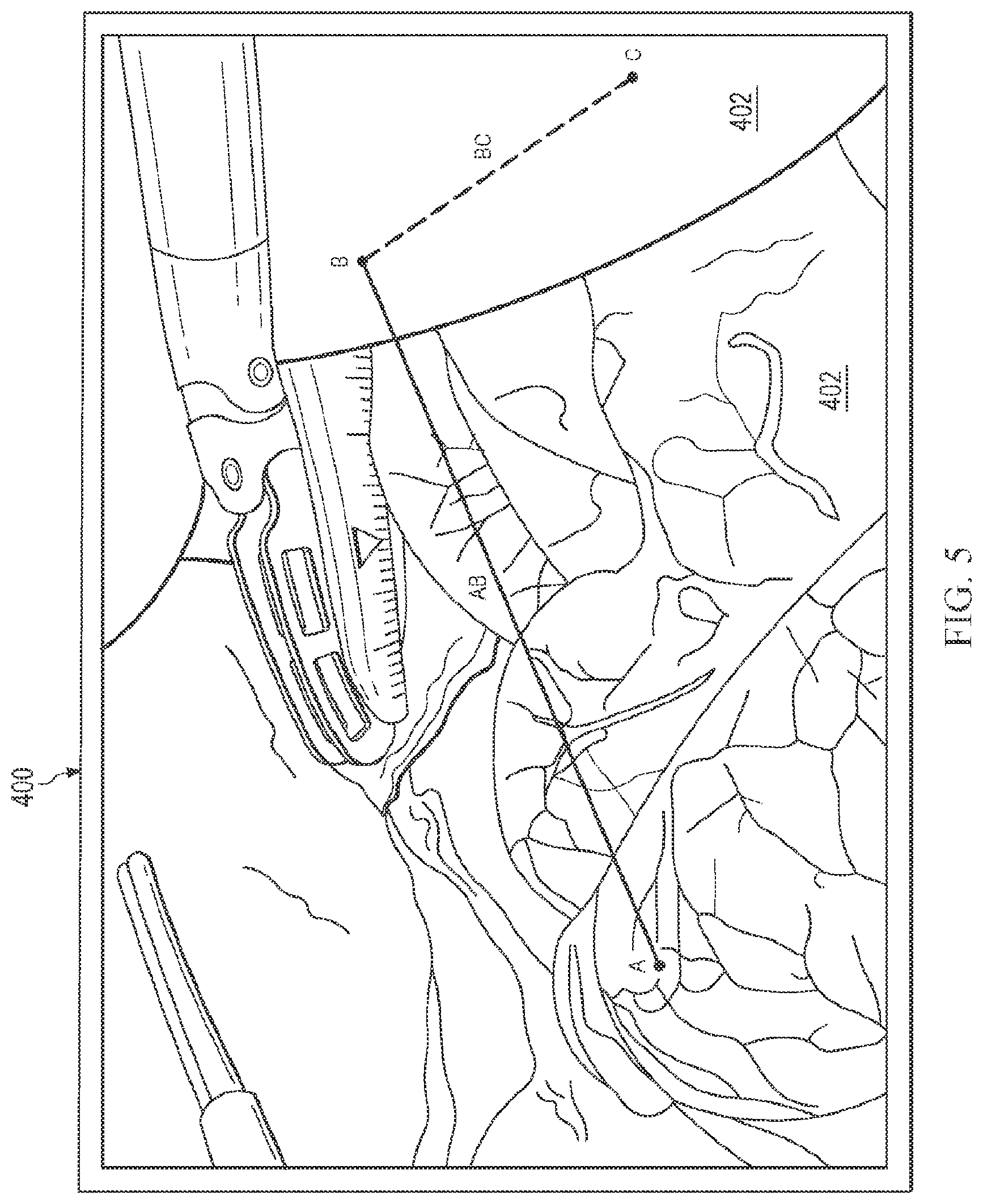 Patent US12564306 Figure 6 – Systems and methods for depth-based measurement in a three-dimensional view