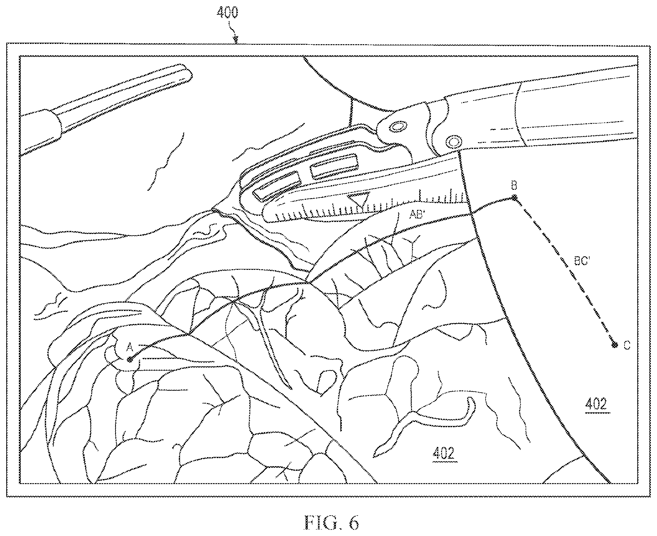 Patent US12564306 Figure 7 – Systems and methods for depth-based measurement in a three-dimensional view