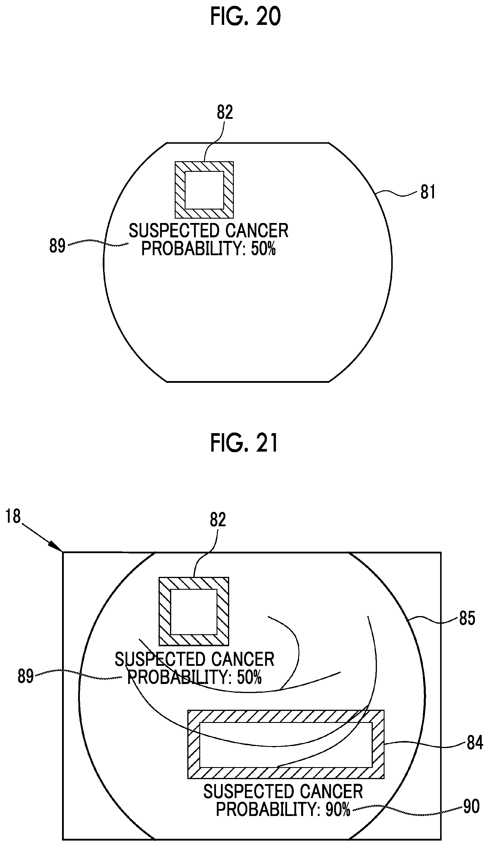 Patent US12564307 Figure 13 – Image analysis processing apparatus, endoscope system, operation method of image analysis processing apparatus, and non-transitory computer readable medium