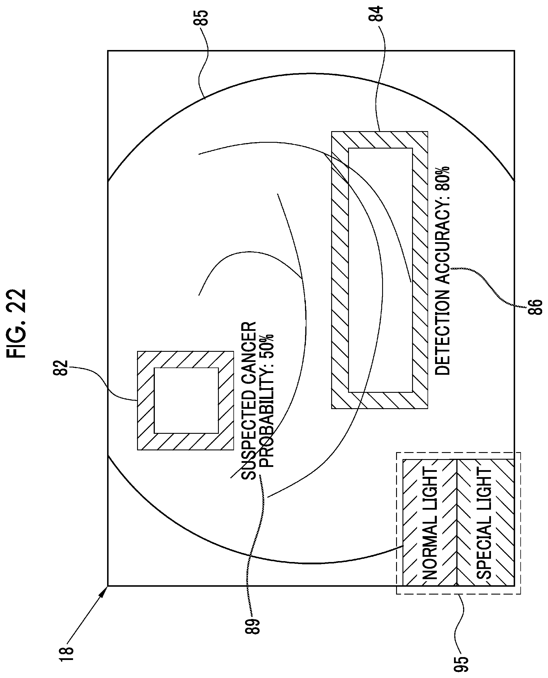Patent US12564307 Figure 14 – Image analysis processing apparatus, endoscope system, operation method of image analysis processing apparatus, and non-transitory computer readable medium