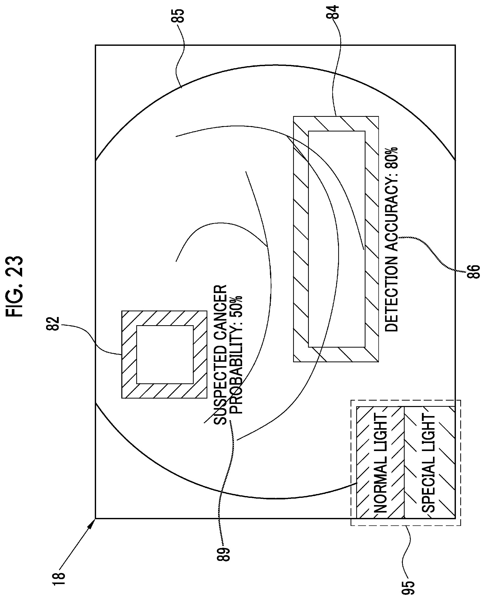 Patent US12564307 Figure 15 – Image analysis processing apparatus, endoscope system, operation method of image analysis processing apparatus, and non-transitory computer readable medium