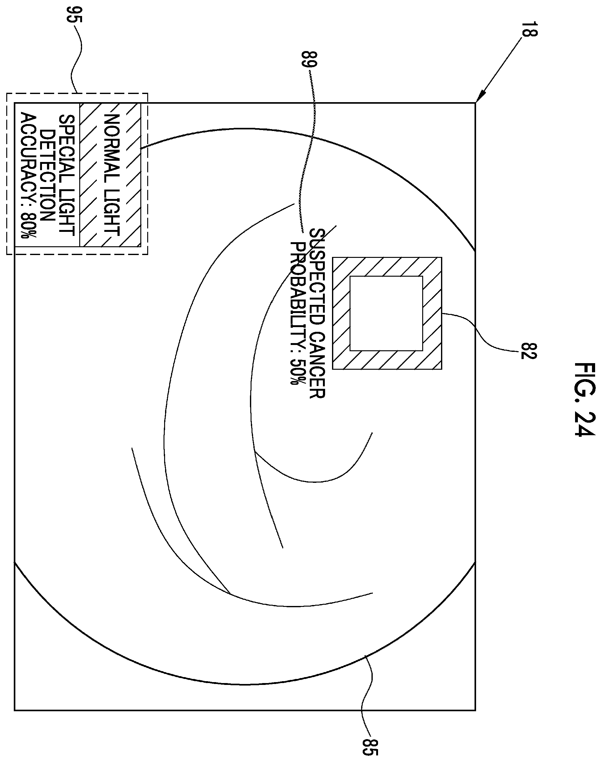 Patent US12564307 Figure 16 – Image analysis processing apparatus, endoscope system, operation method of image analysis processing apparatus, and non-transitory computer readable medium