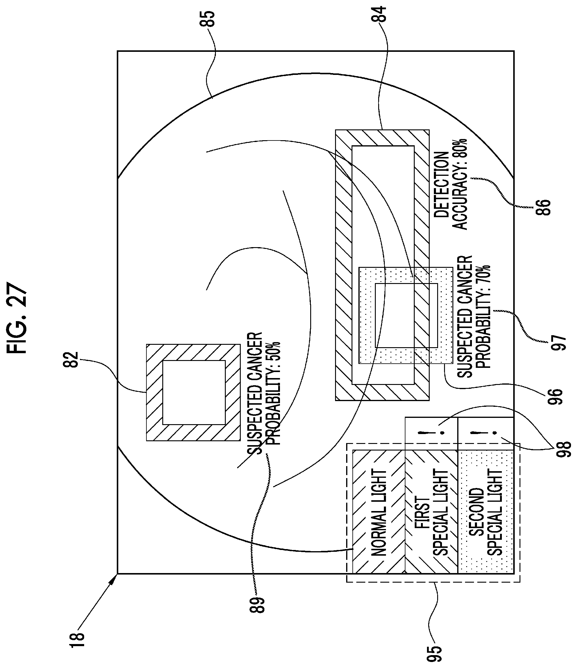 Patent US12564307 Figure 19 – Image analysis processing apparatus, endoscope system, operation method of image analysis processing apparatus, and non-transitory computer readable medium