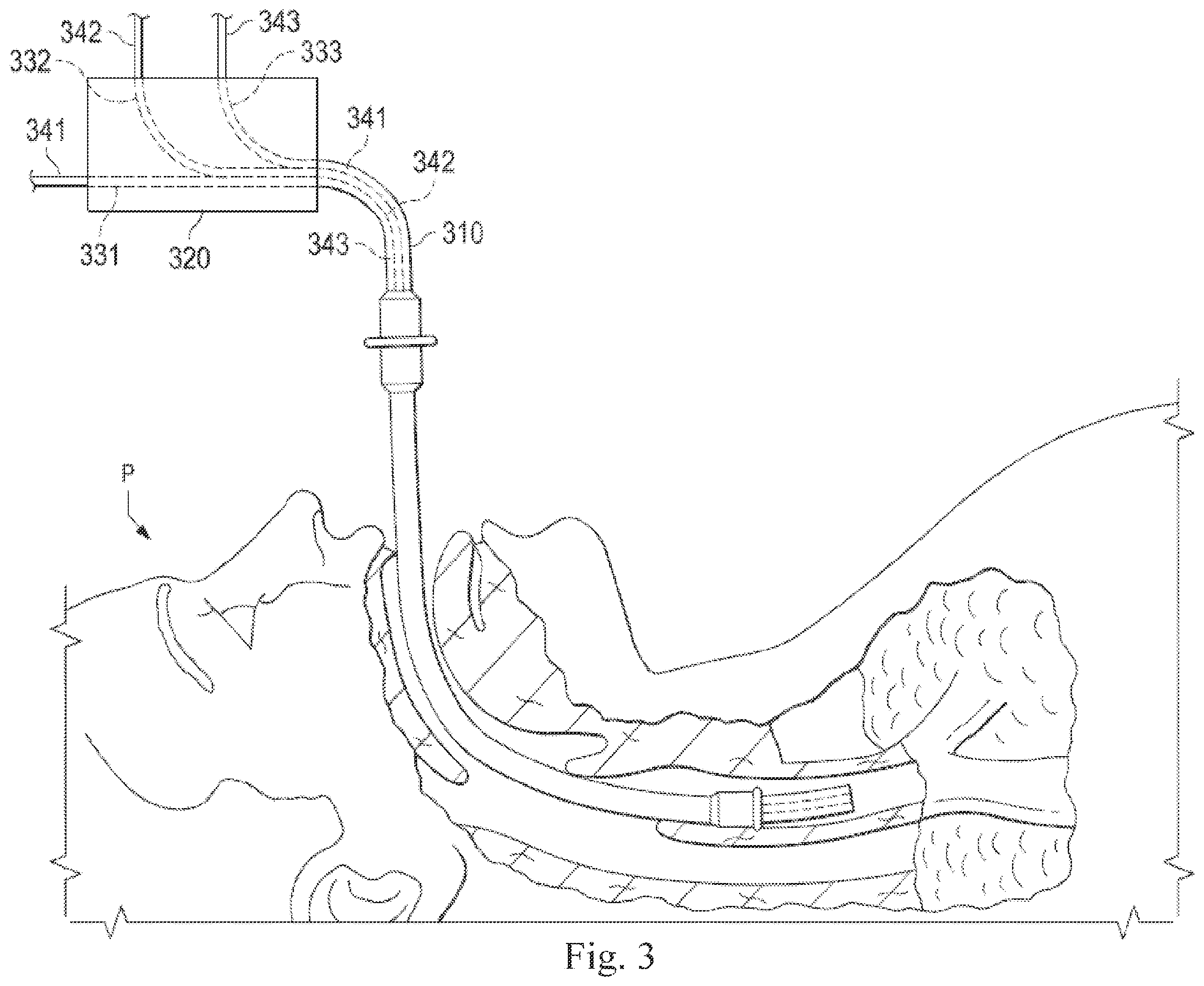 Patent US12564313 Figure 3 – Systems and methods of integrated real-time visualization