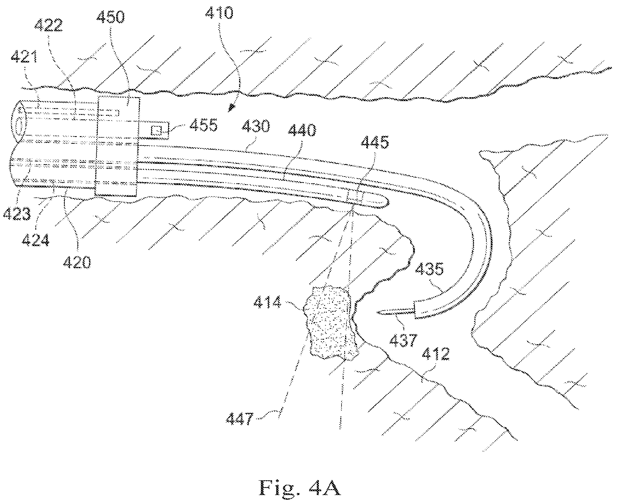 Patent US12564313 Figure 4 – Systems and methods of integrated real-time visualization