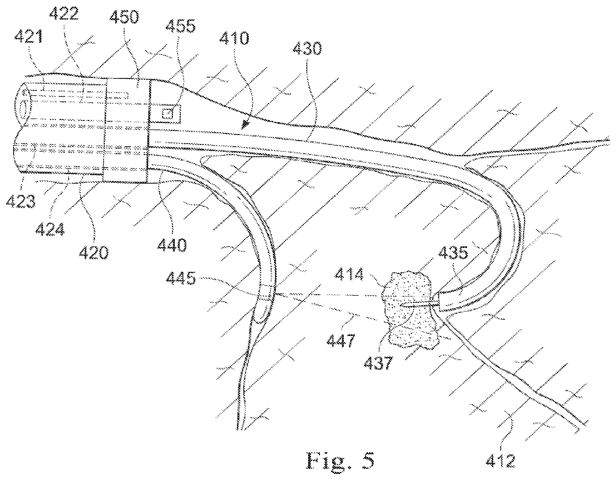 Patent US12564313 Figure 7 – Systems and methods of integrated real-time visualization