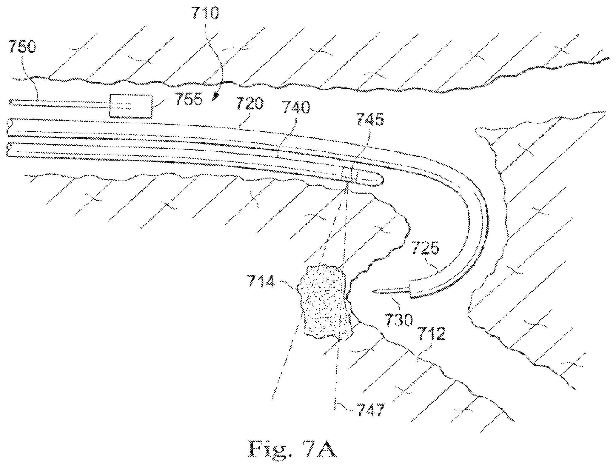 Patent US12564313 Figure 9 – Systems and methods of integrated real-time visualization
