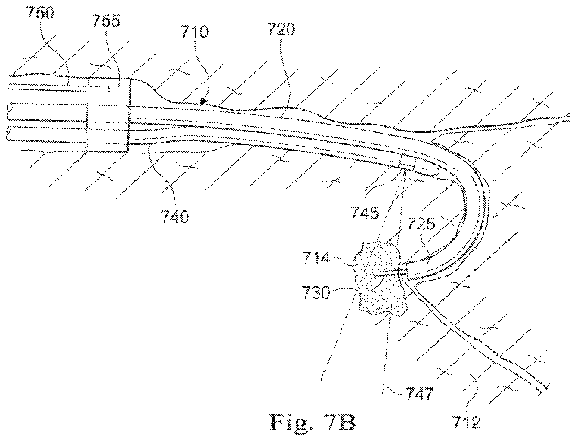 Patent US12564313 Figure 10 – Systems and methods of integrated real-time visualization