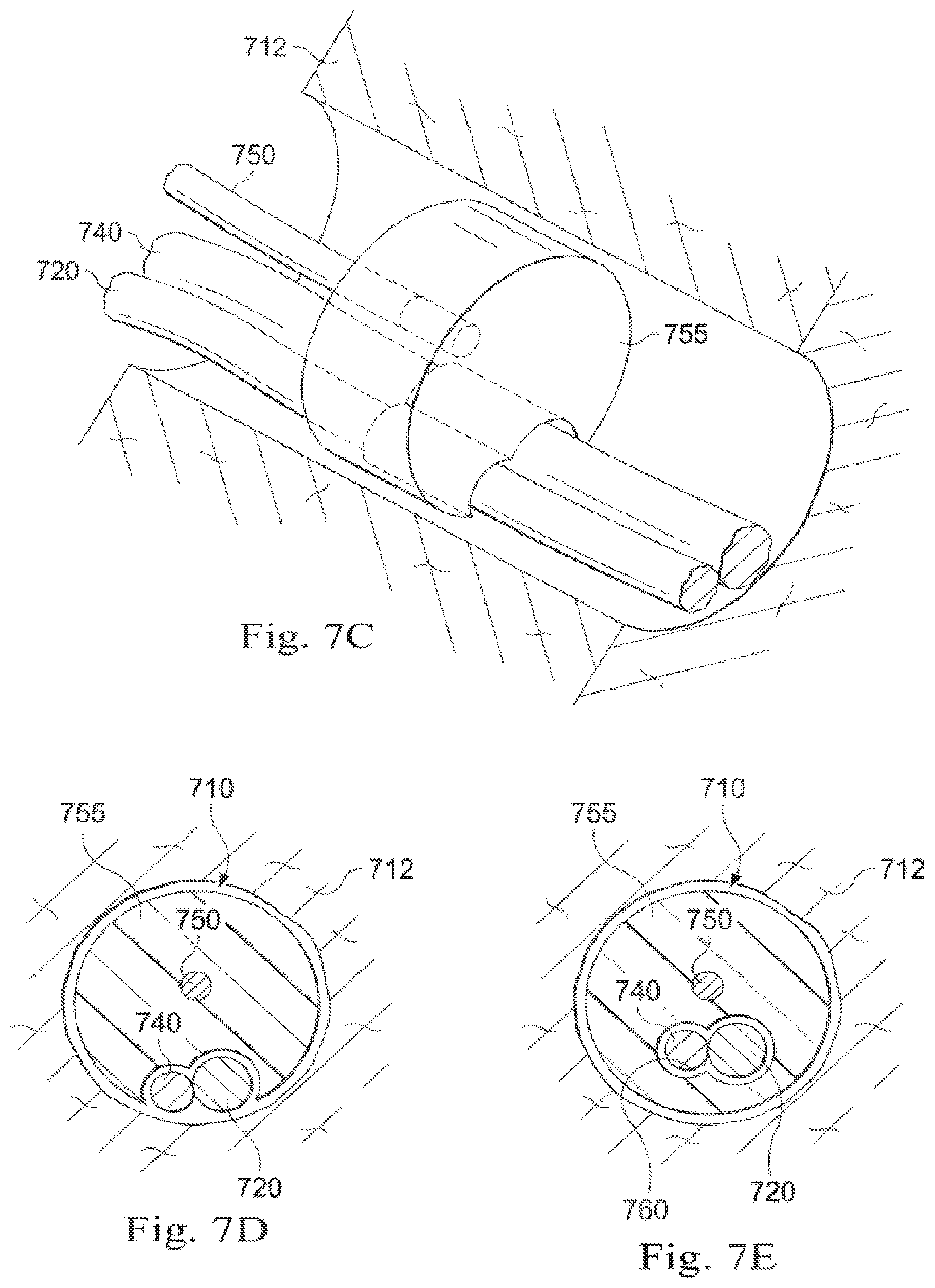 Patent US12564313 Figure 11 – Systems and methods of integrated real-time visualization