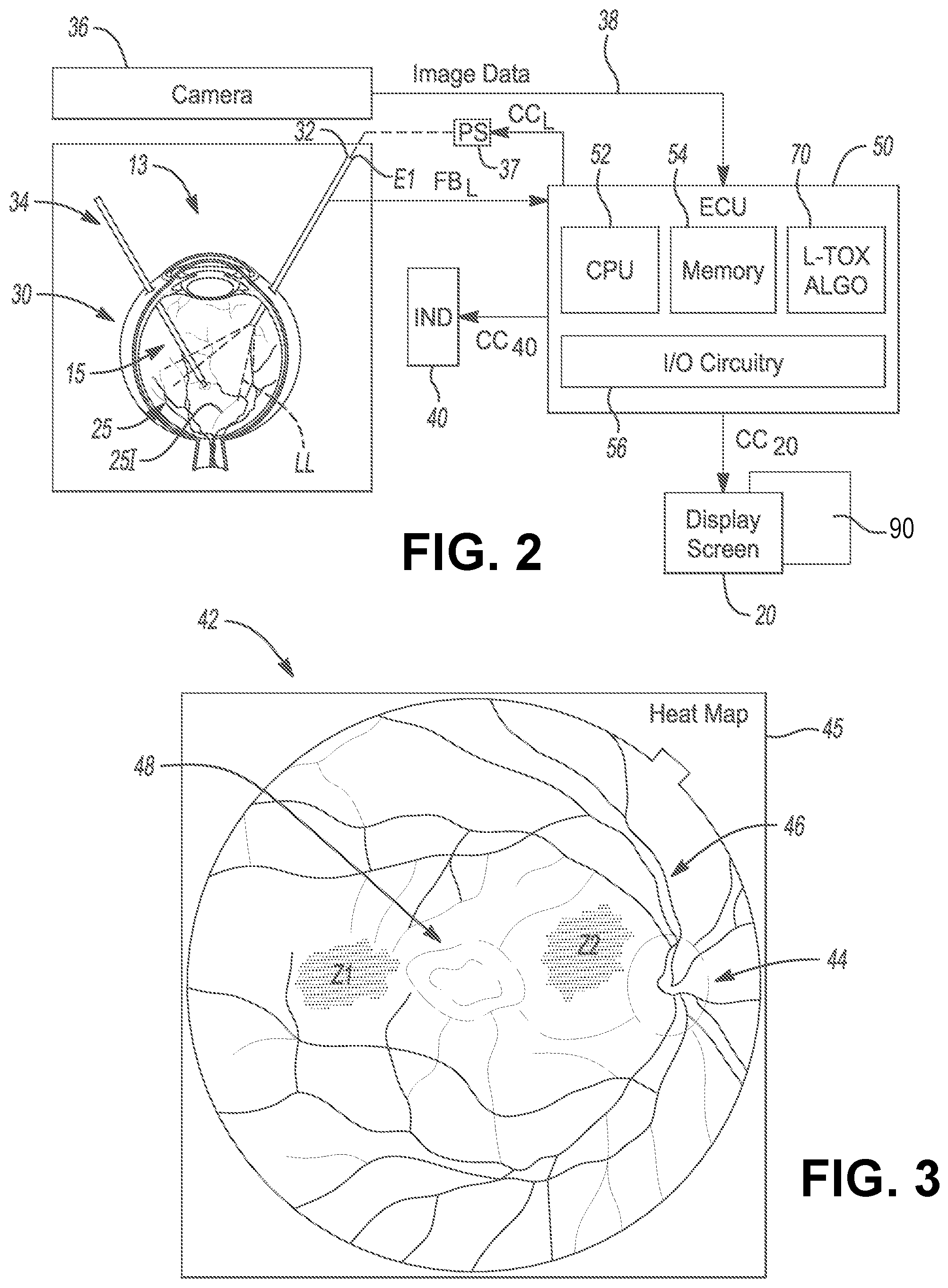 Patent US12564317 Figure 2 – Systems and methods for light modulation during ophthalmic surgery