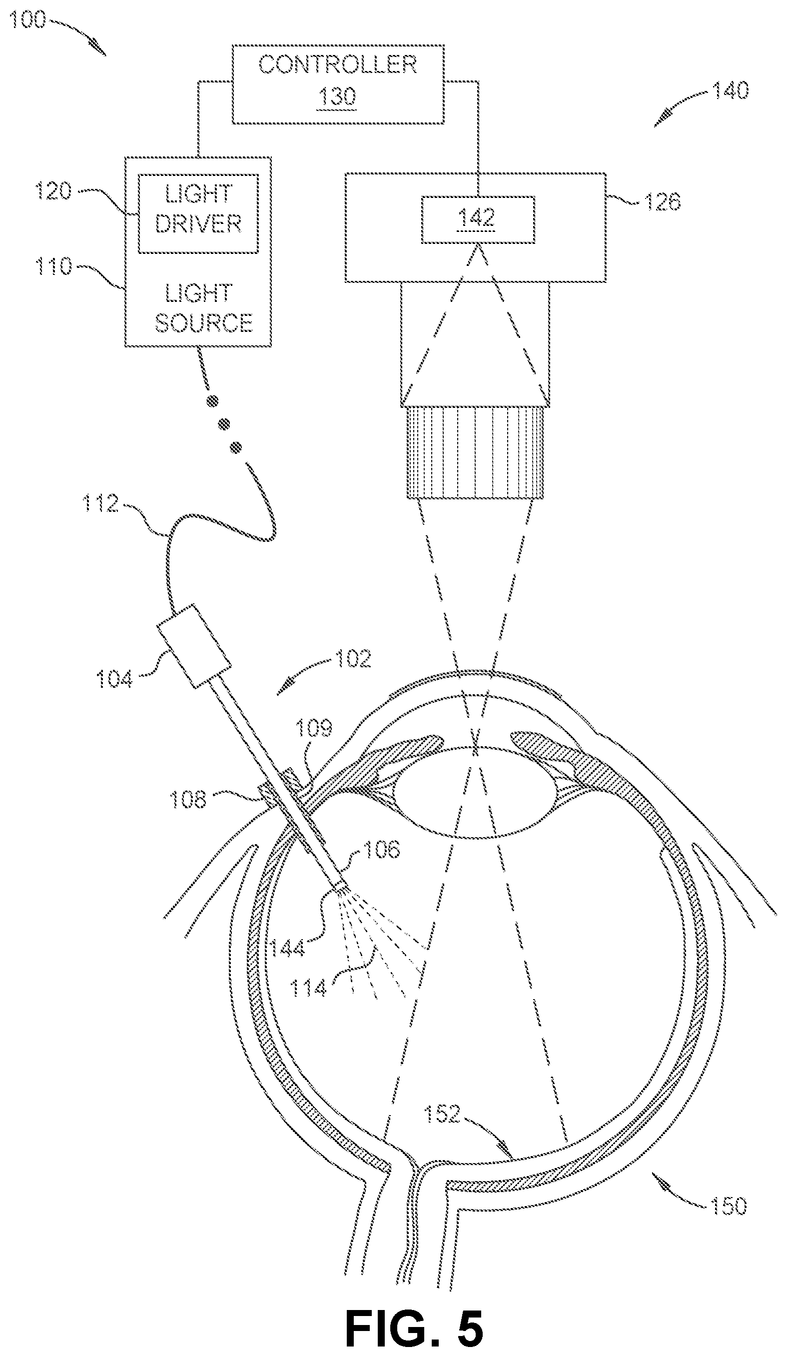 Patent US12564317 Figure 4 – Systems and methods for light modulation during ophthalmic surgery