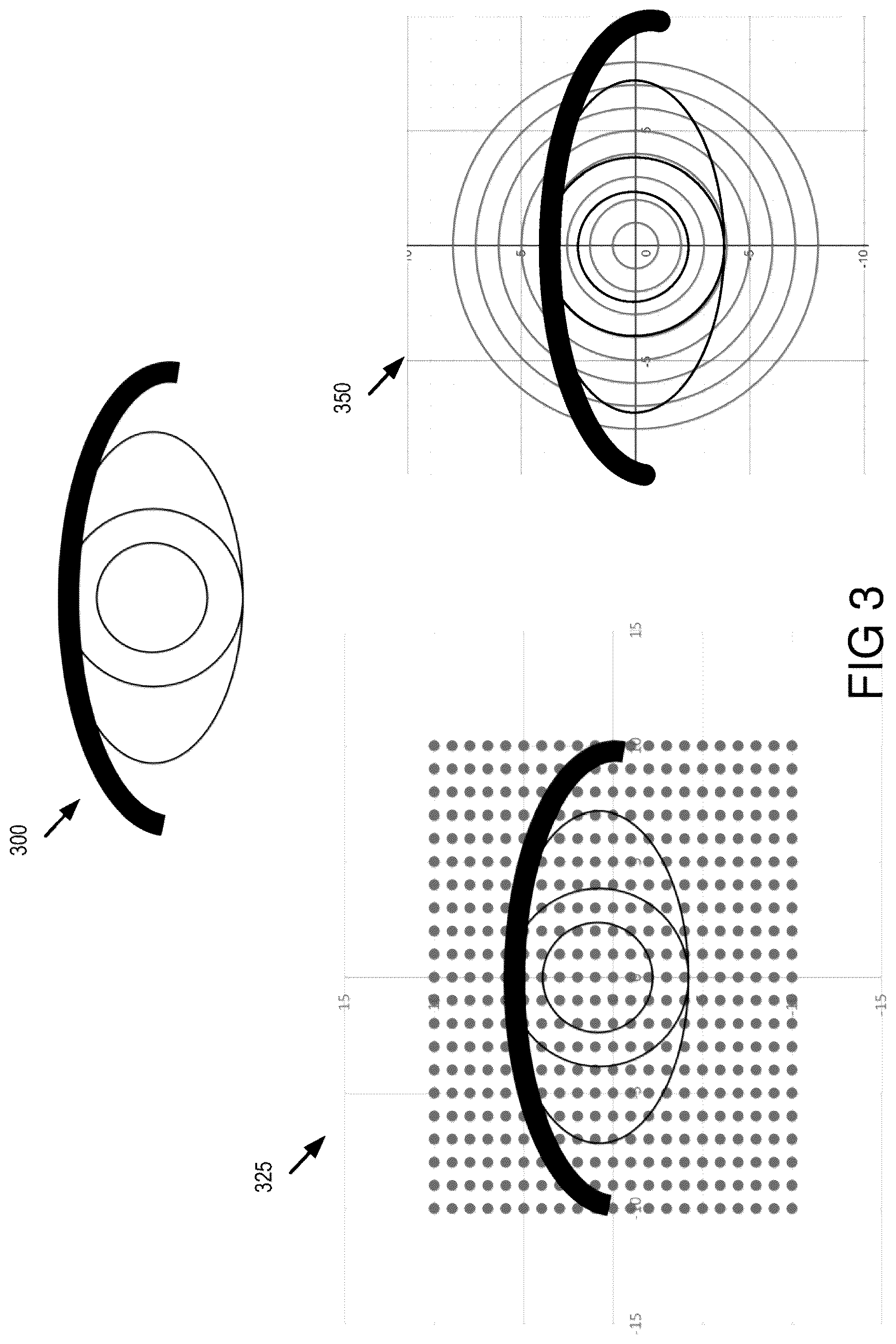 Patent US12564322 Figure 3 – Head-mounted system for measuring ptosis