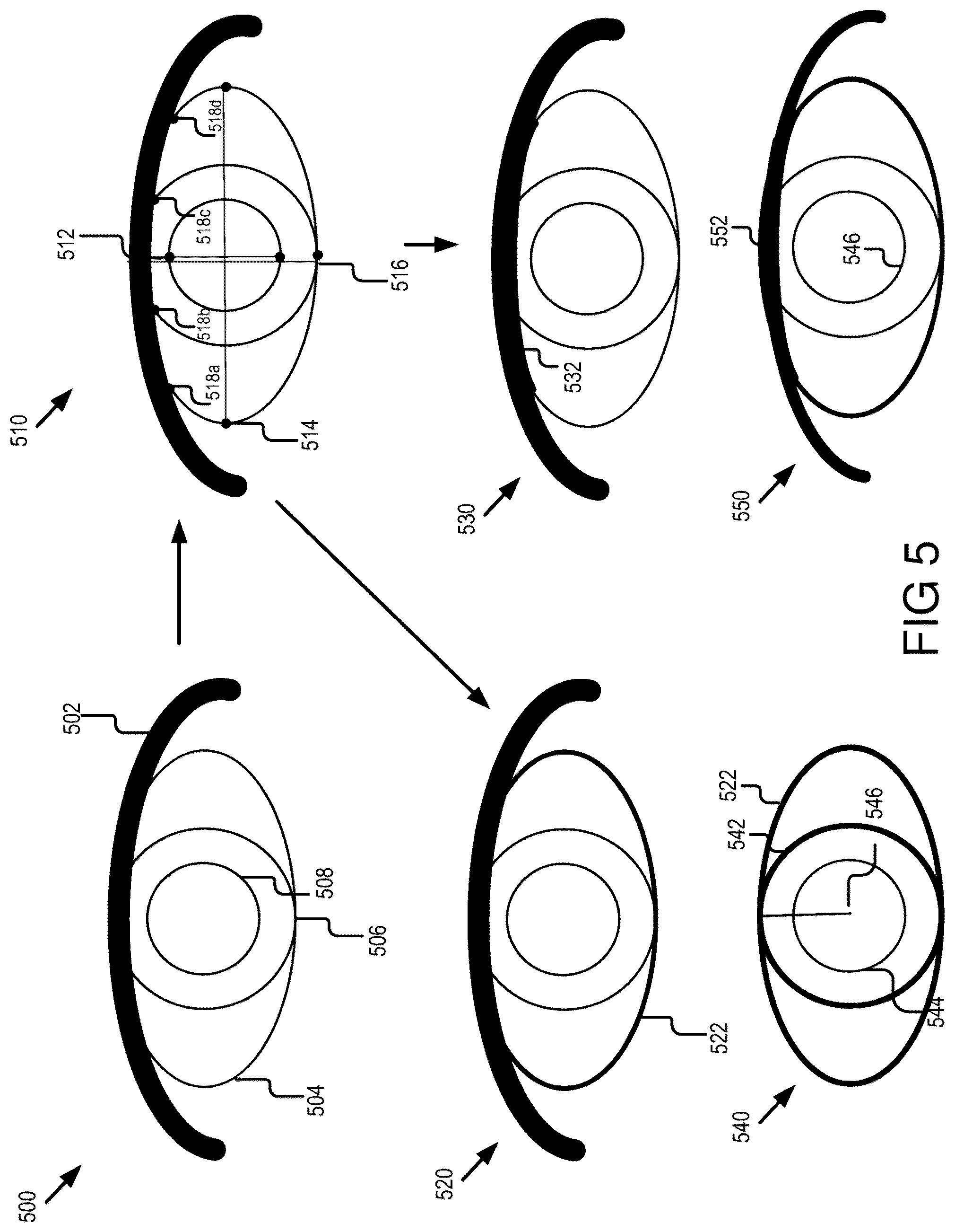 Patent US12564322 Figure 5 – Head-mounted system for measuring ptosis