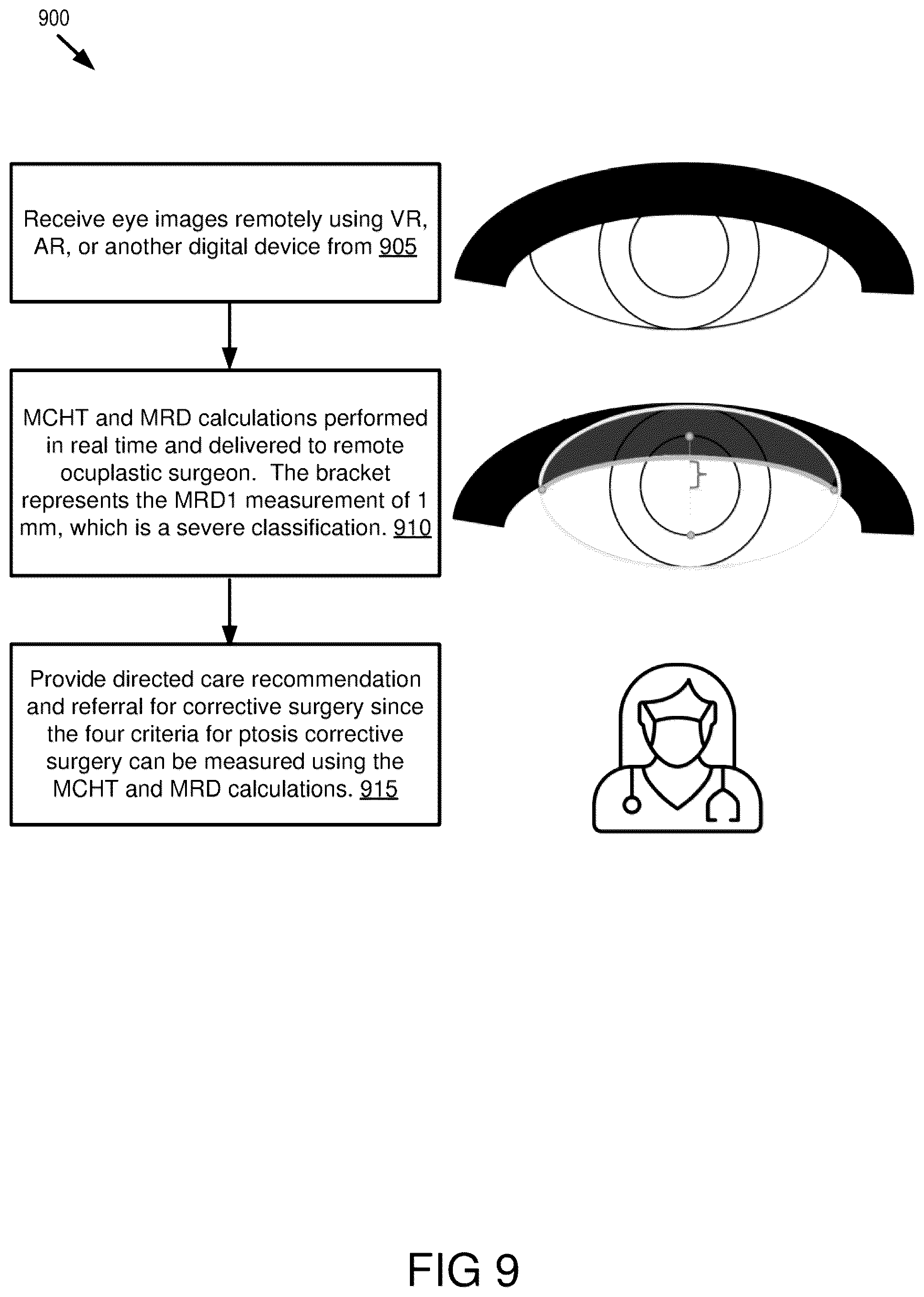 Patent US12564322 Figure 10 – Head-mounted system for measuring ptosis