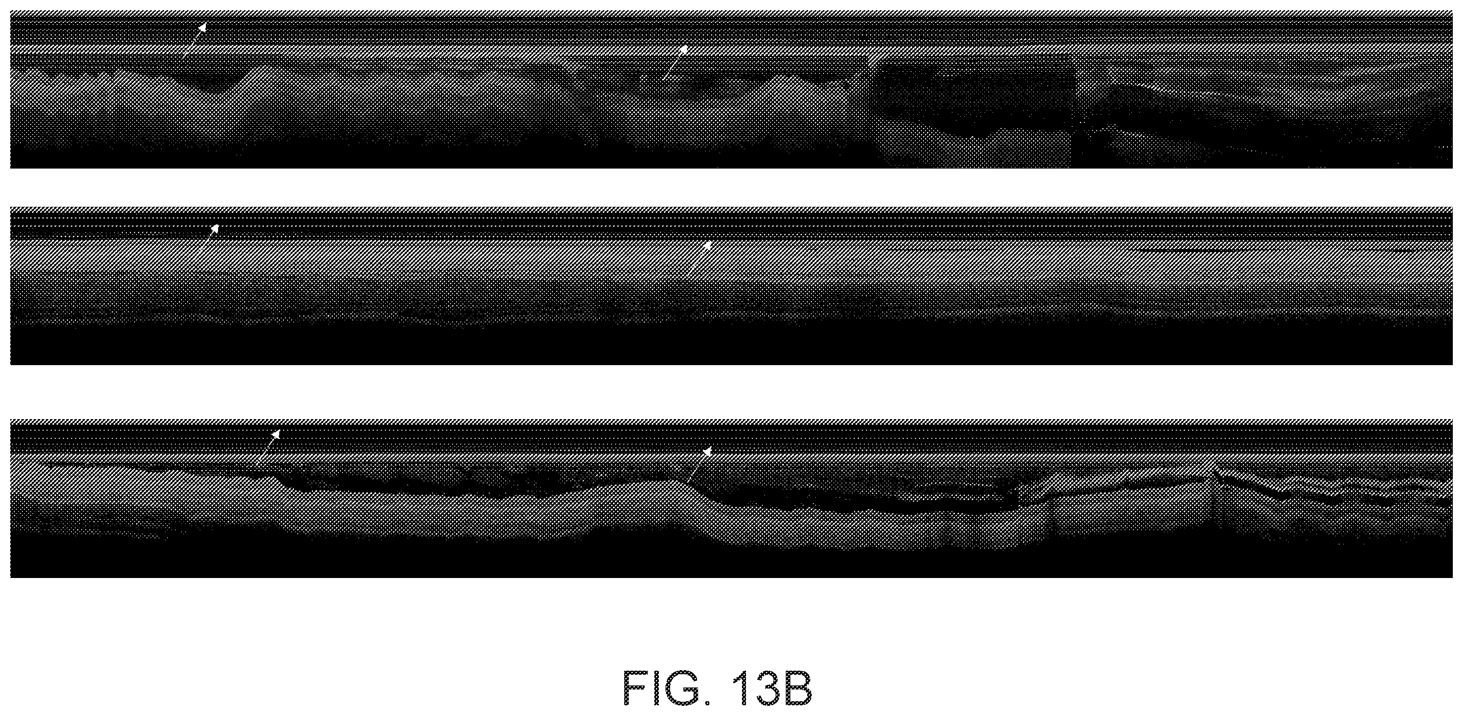 Patent US12564327 Figure 16 – Methods and systems for conversion of one data type to another