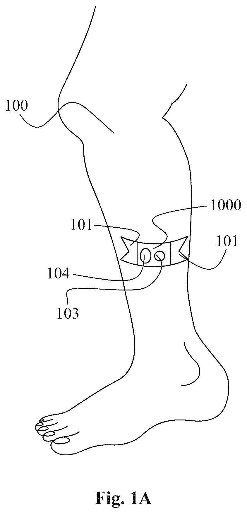 Patent US12564336 Figure 1 – Remote controlled physical activity monitoring