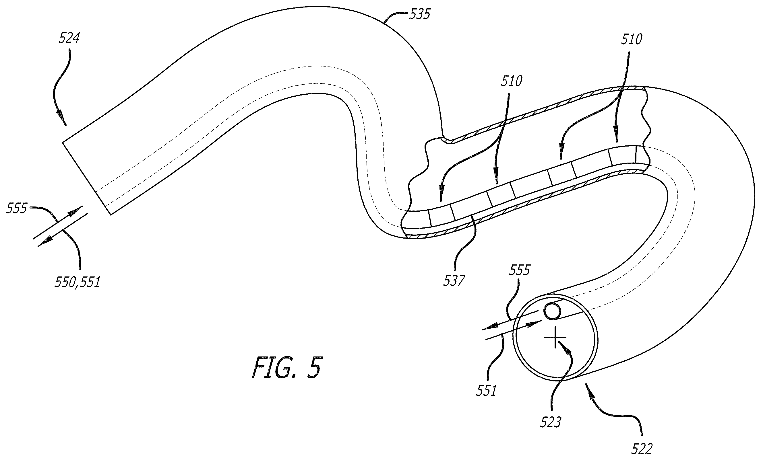Patent US12564340 Figure 6 – Eccentric single-core fiber-optic enabled medical device