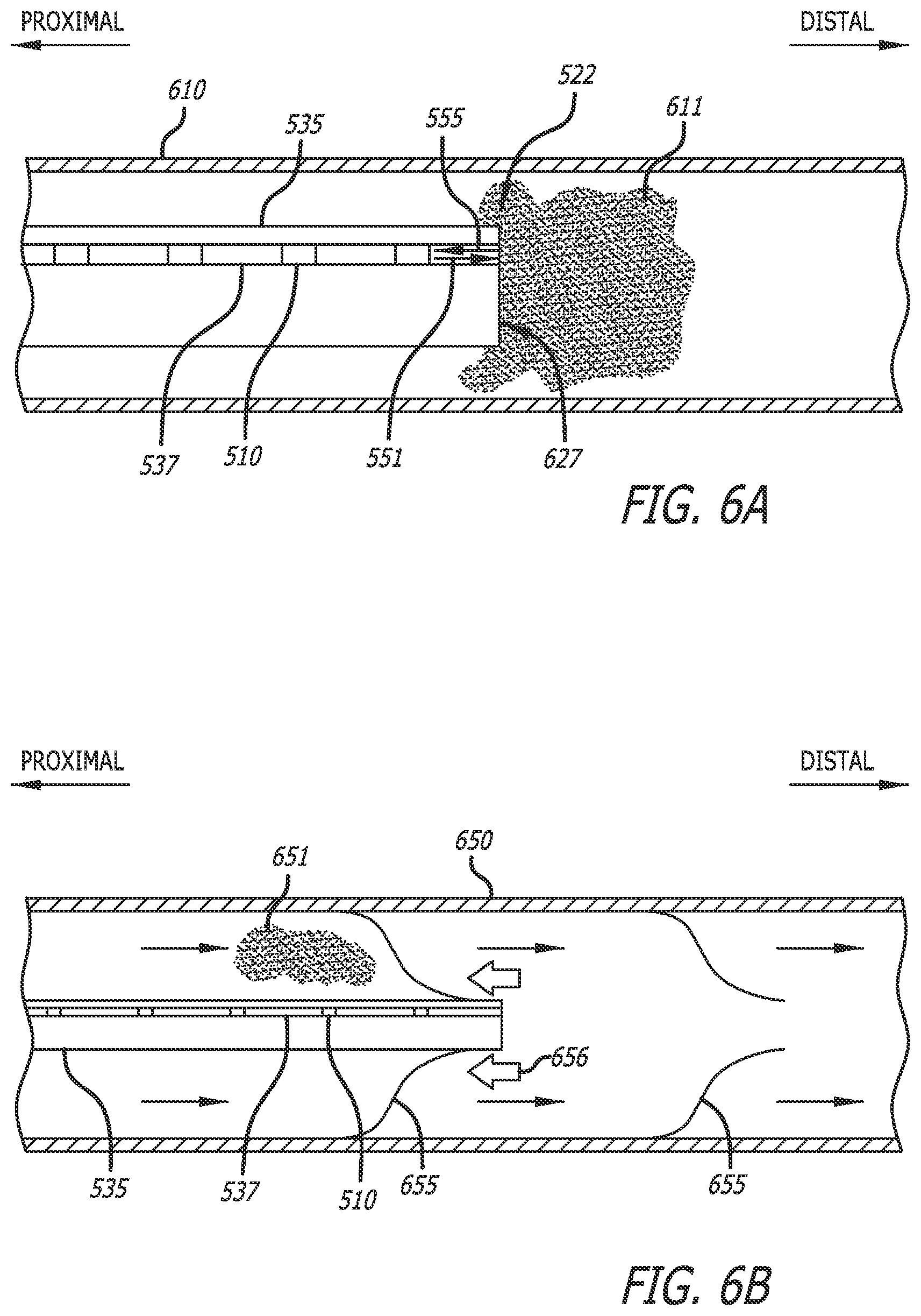 Patent US12564340 Figure 7 – Eccentric single-core fiber-optic enabled medical device