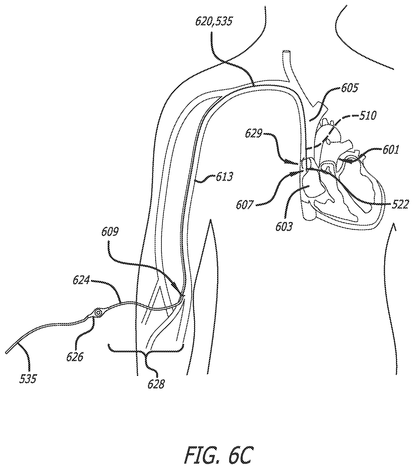 Patent US12564340 Figure 8 – Eccentric single-core fiber-optic enabled medical device
