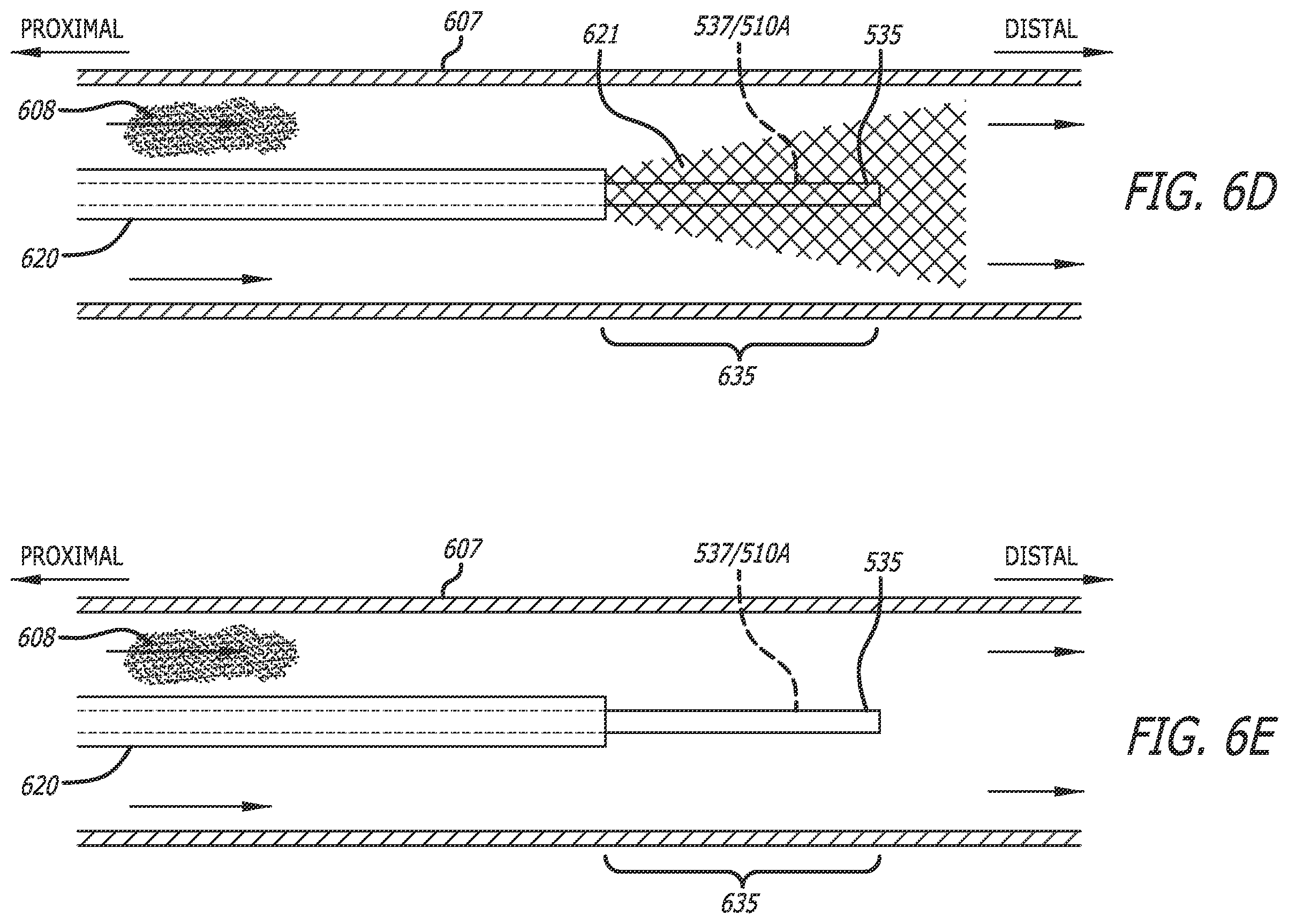 Patent US12564340 Figure 9 – Eccentric single-core fiber-optic enabled medical device
