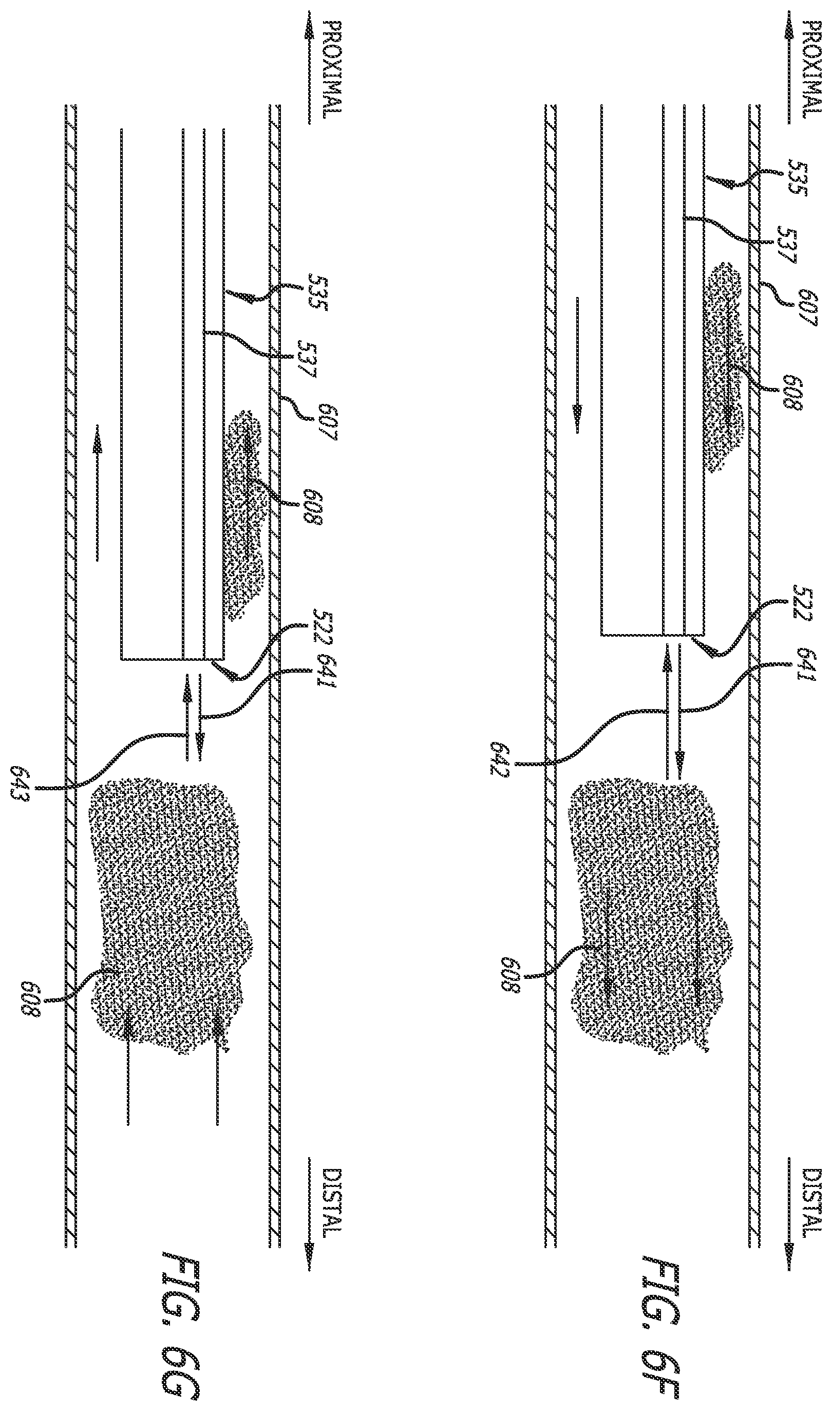Patent US12564340 Figure 10 – Eccentric single-core fiber-optic enabled medical device