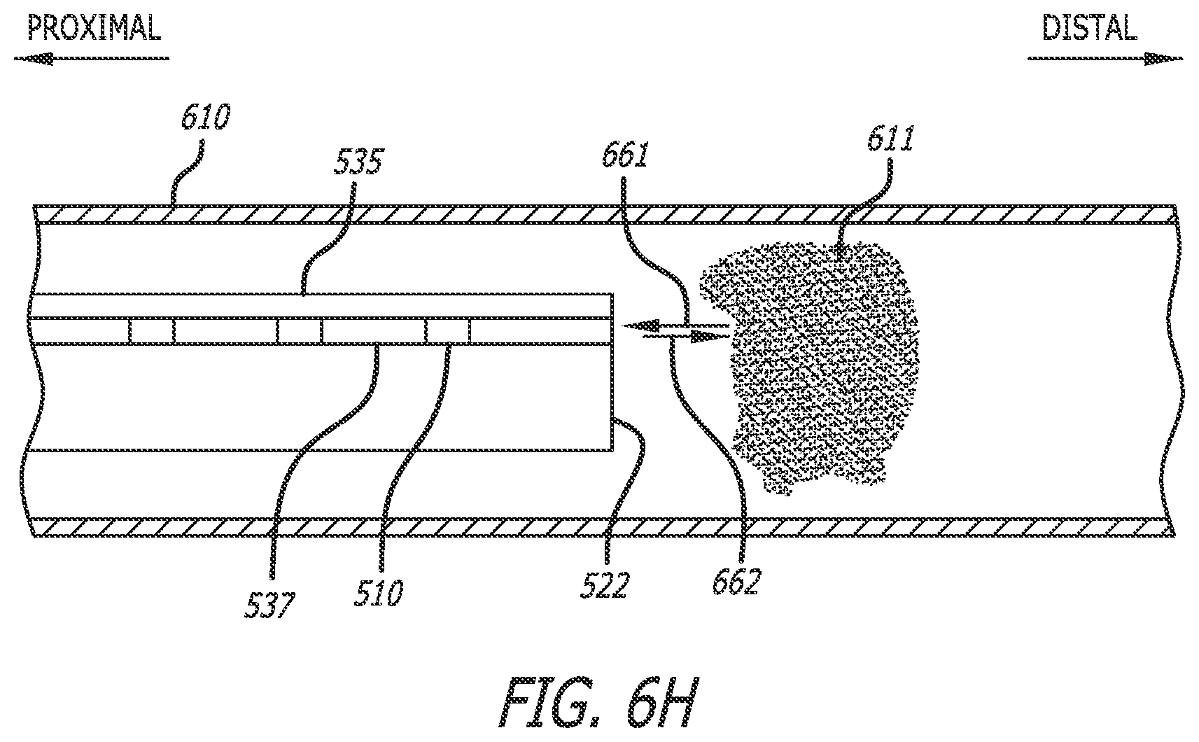 Patent US12564340 Figure 11 – Eccentric single-core fiber-optic enabled medical device