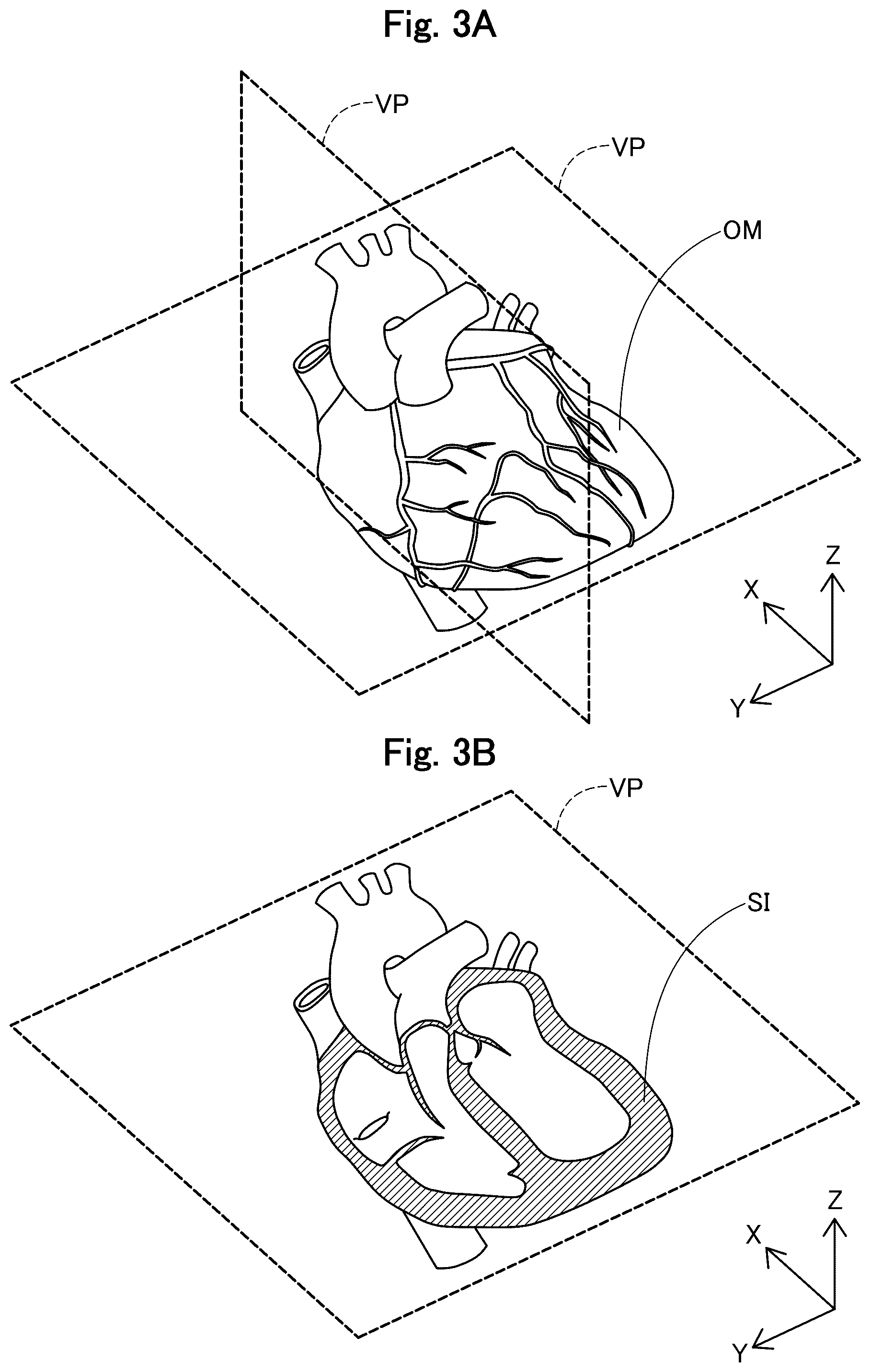 Patent US12564345 Figure 3 – Medical apparatus, and image generation method for visualizing temporal trends of biomagnetic data on an organ model